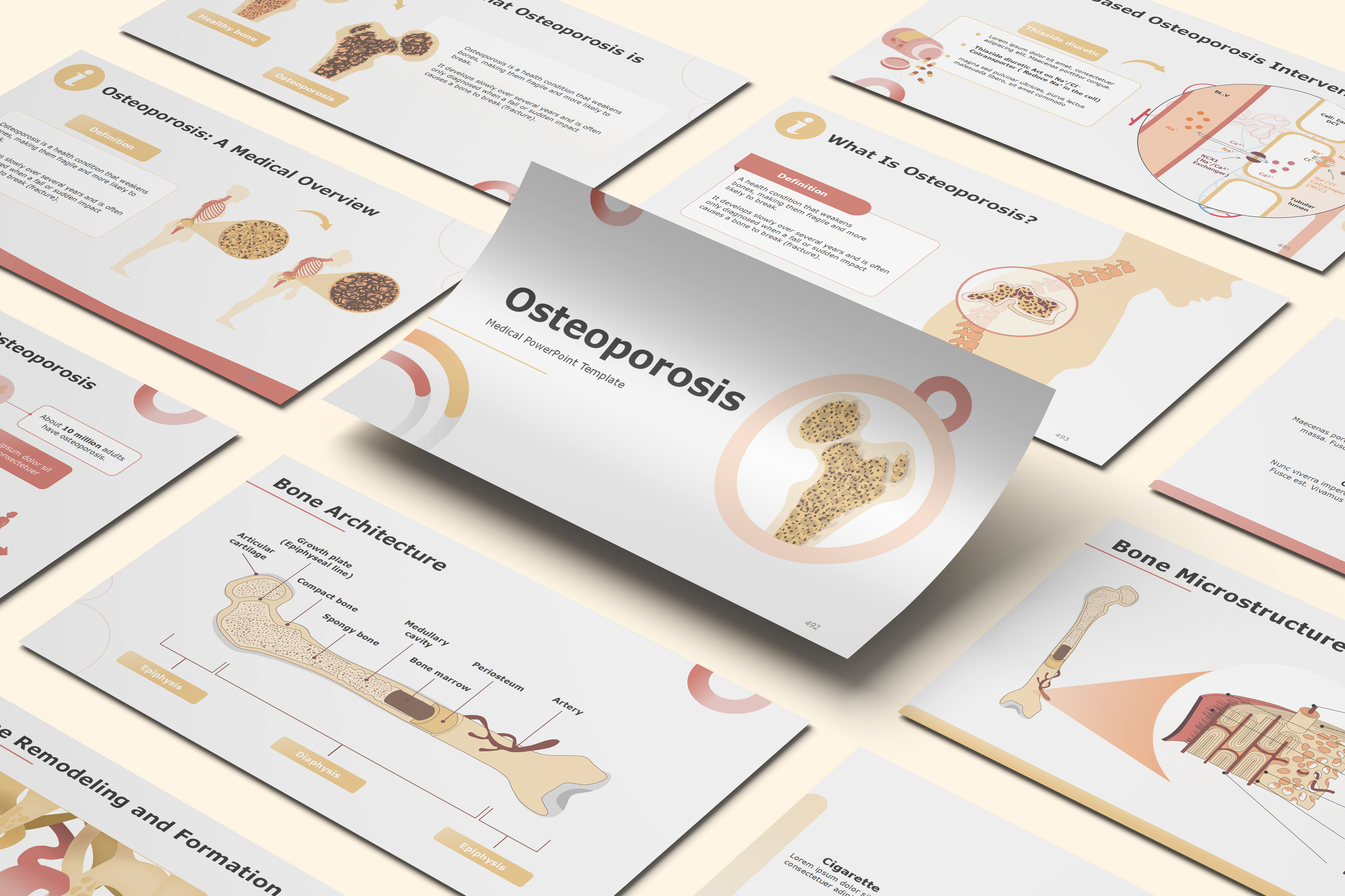 Osteoporosis PowerPoint Template