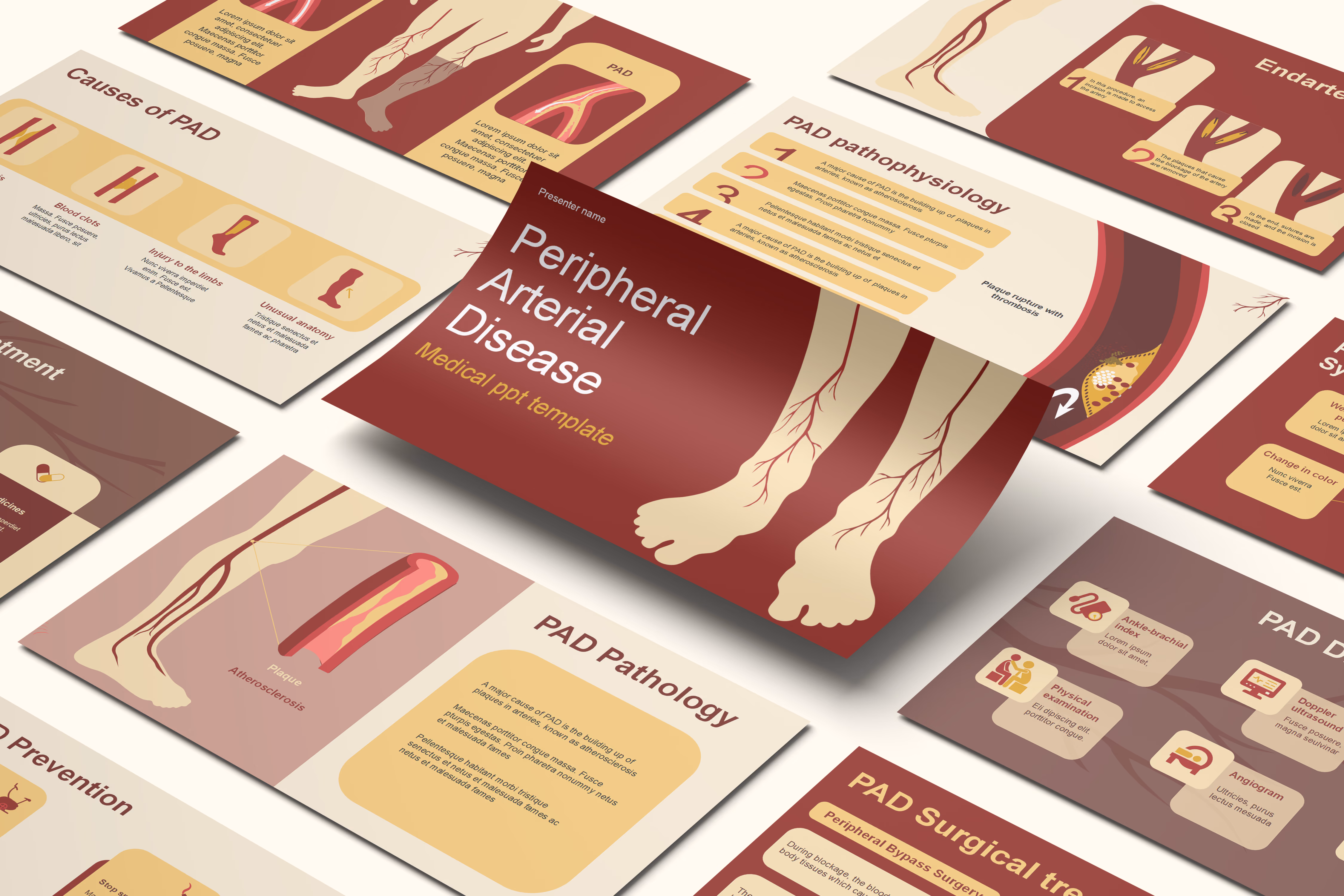 Peripheral Arterial Disease Overview Presentation Template
