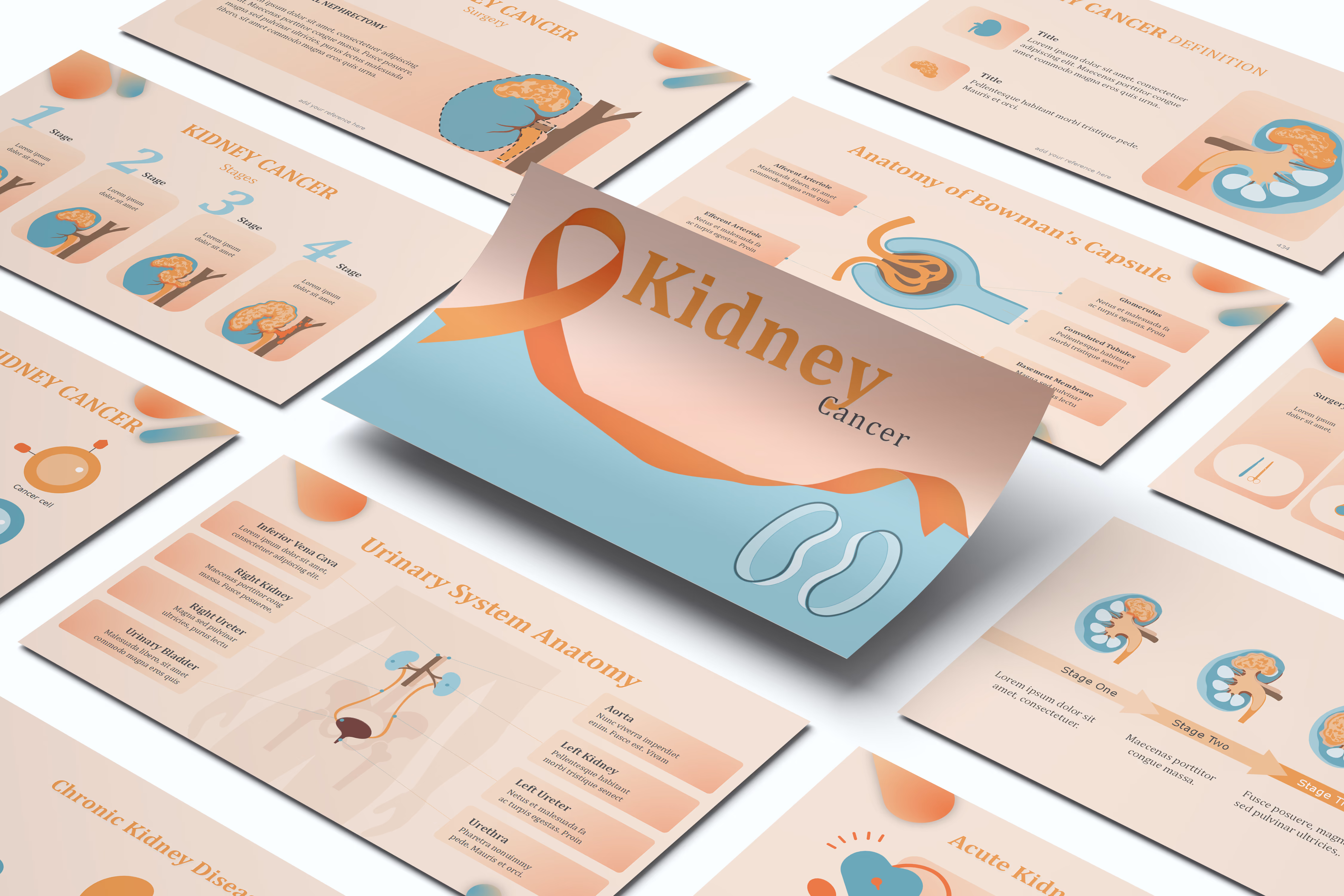 Kidney Cancer PowerPoint Template