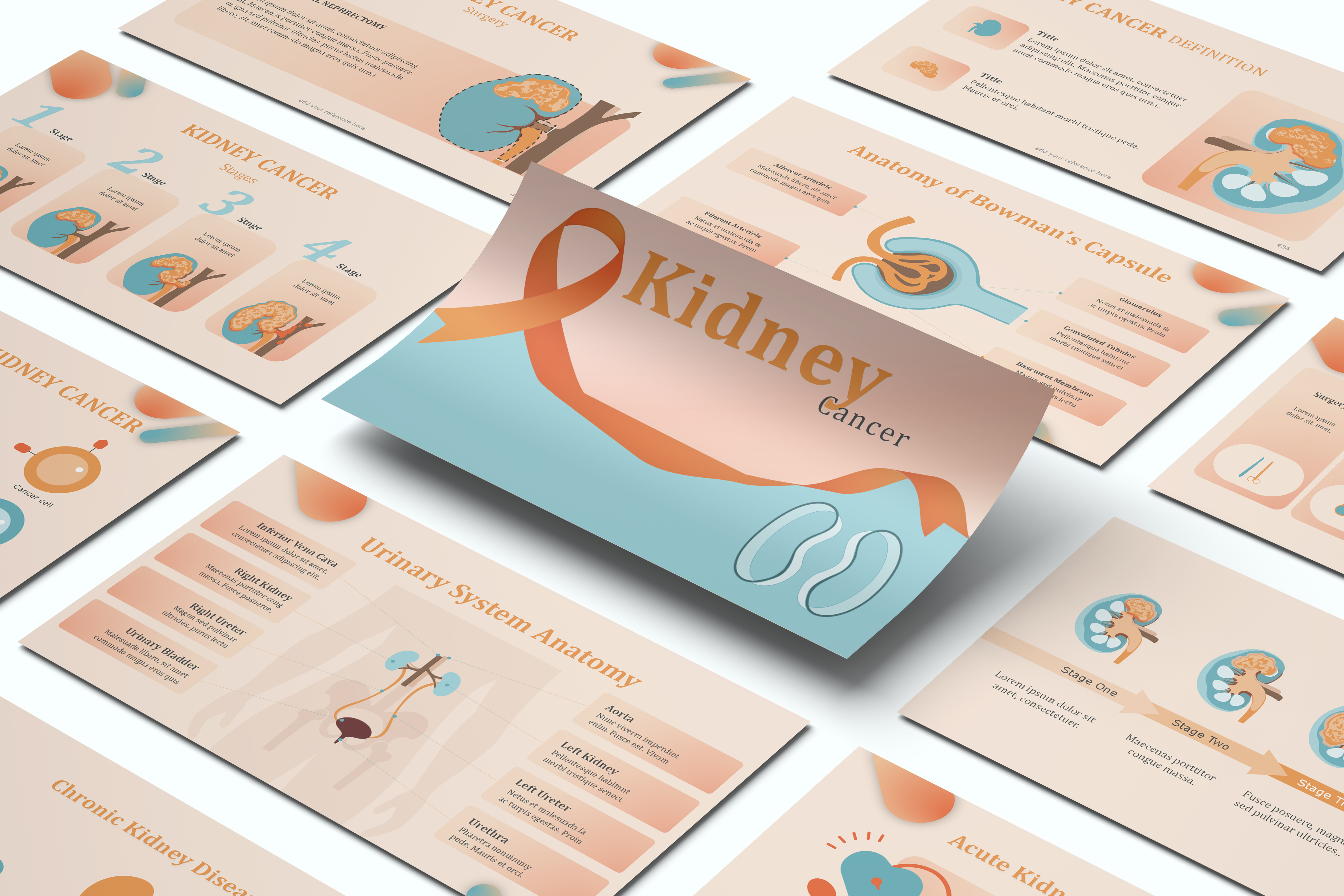 Kidney Cancer PowerPoint Template