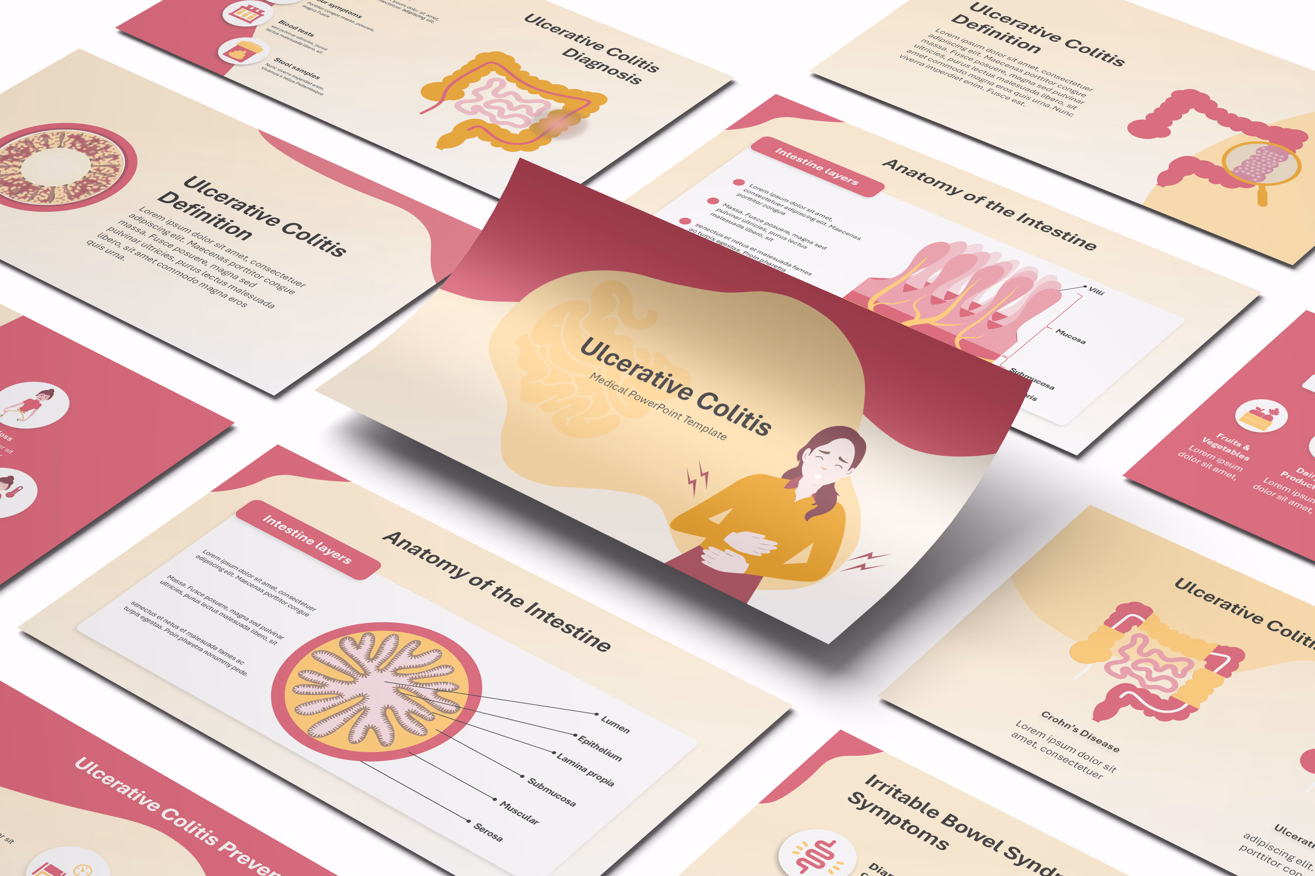 Ulcerative Colitis PowerPoint Template