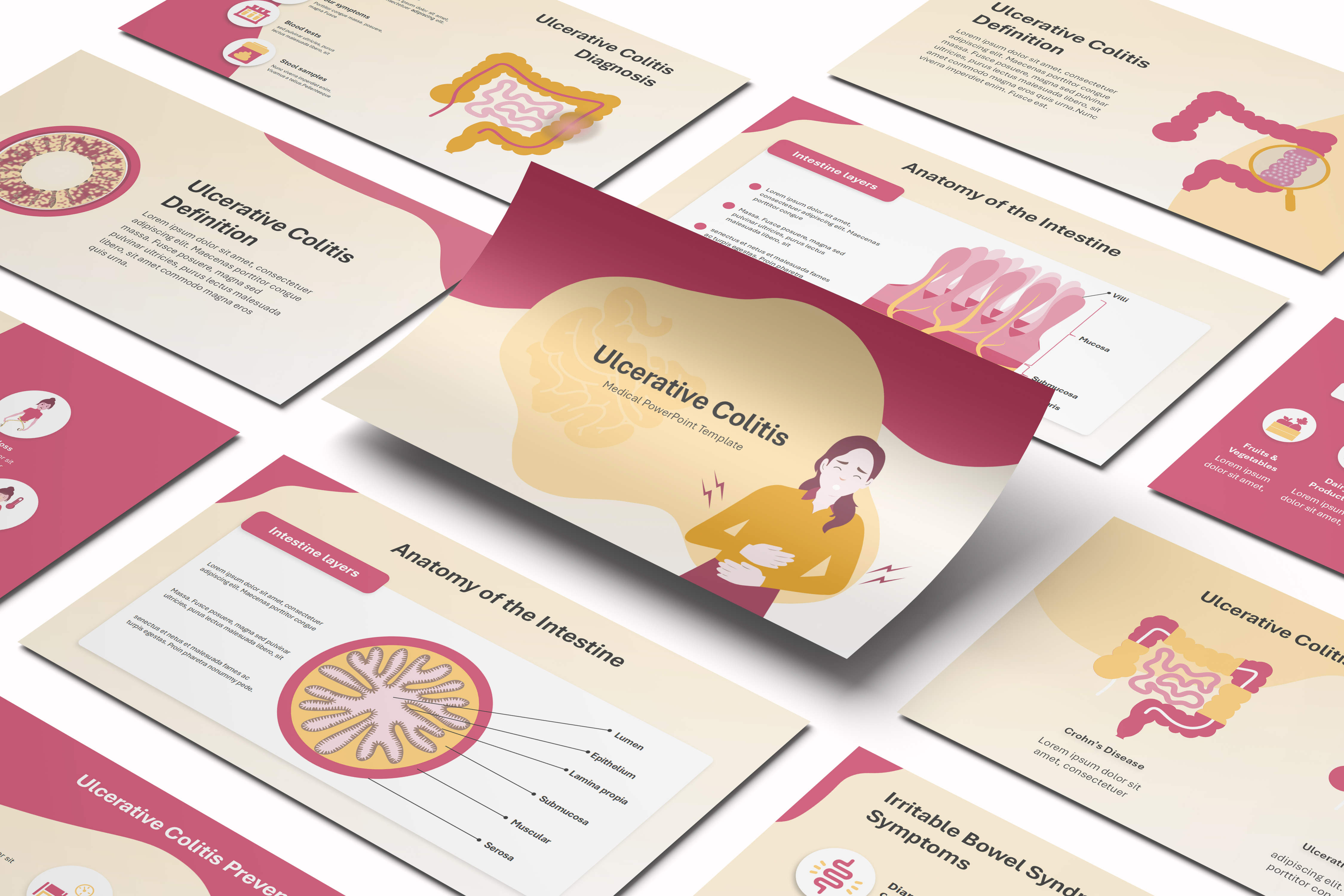 Ulcerative Colitis PowerPoint Template