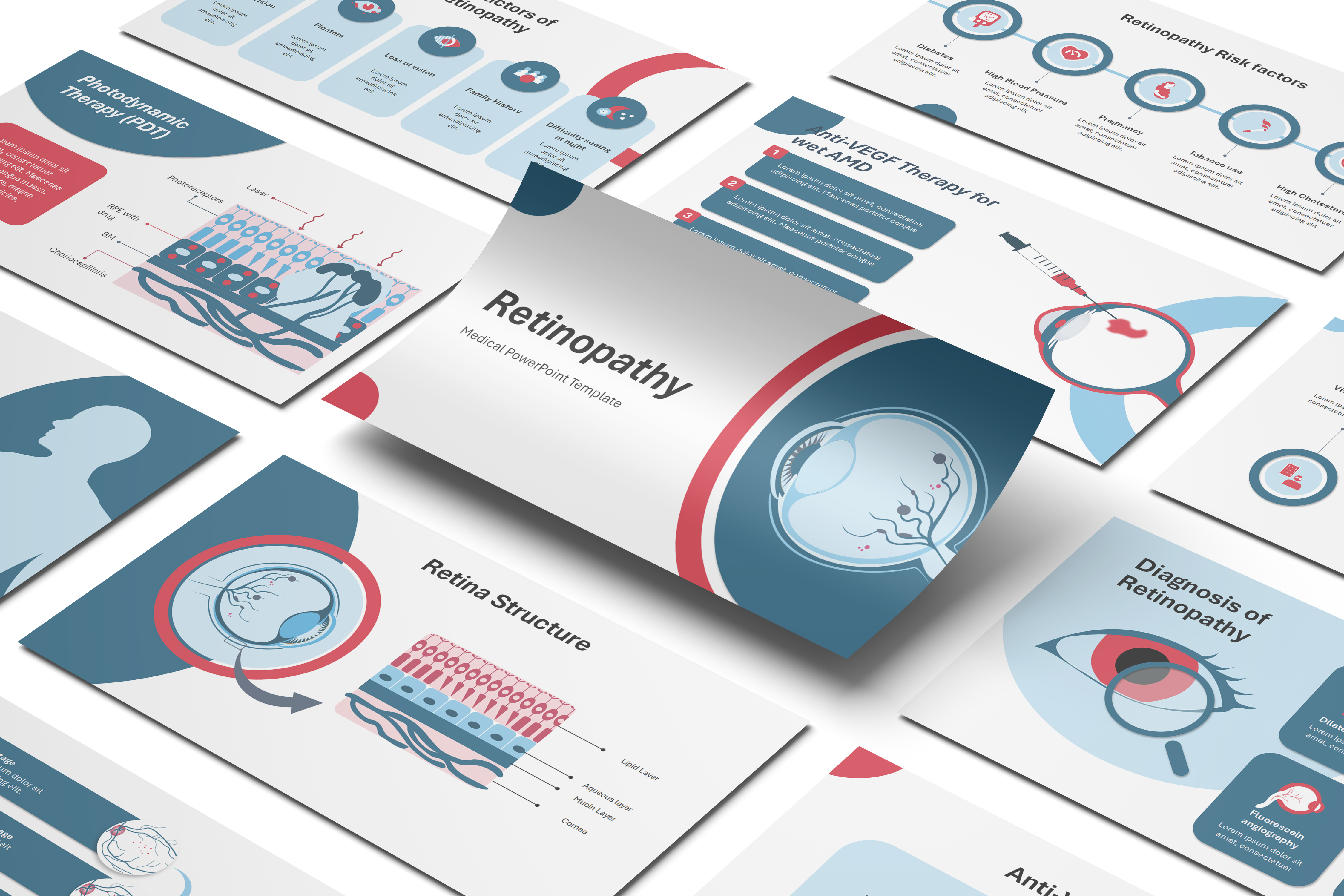 Retinopathy PowerPoint Template
