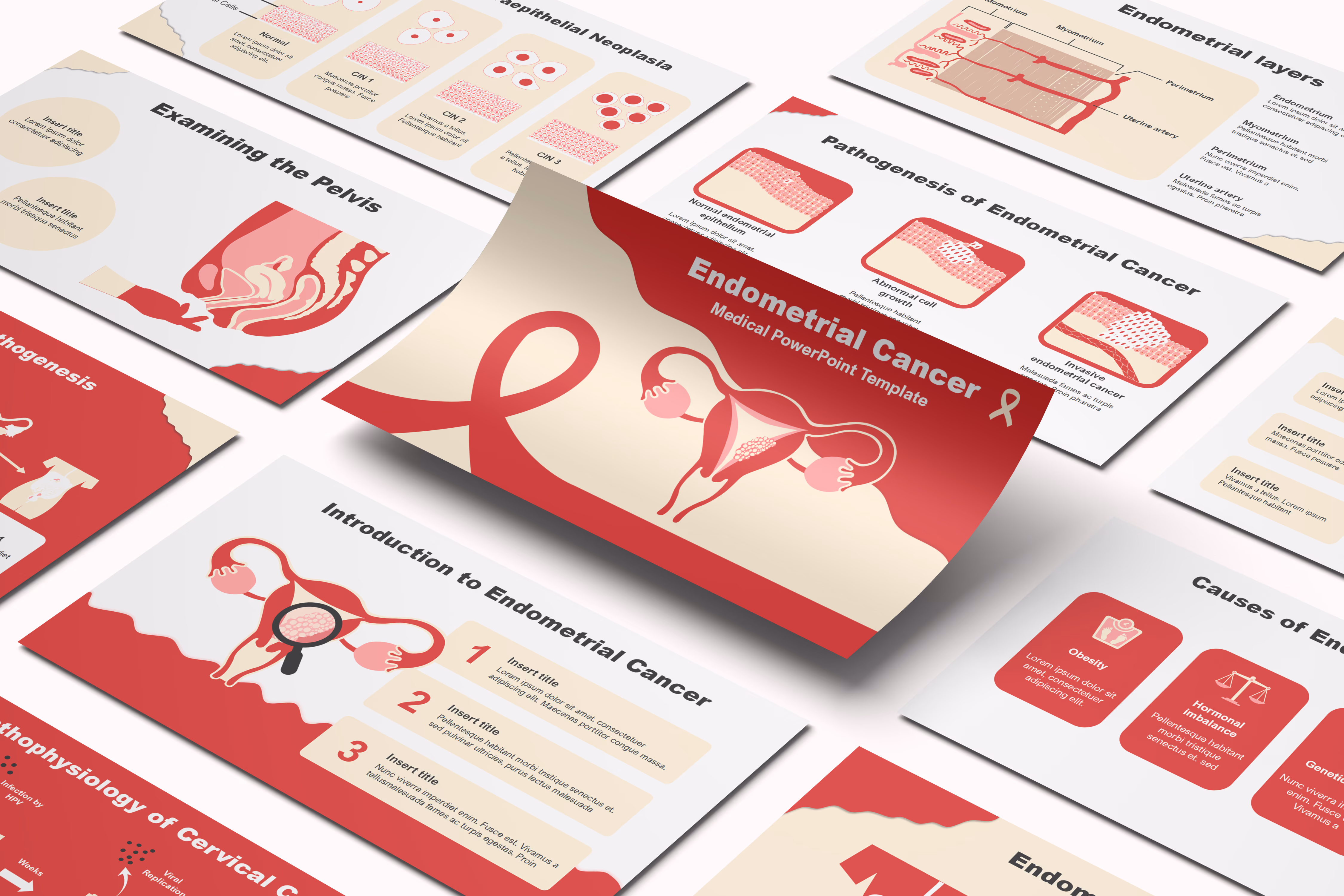 Endometrial Cancer PowerPoint Template