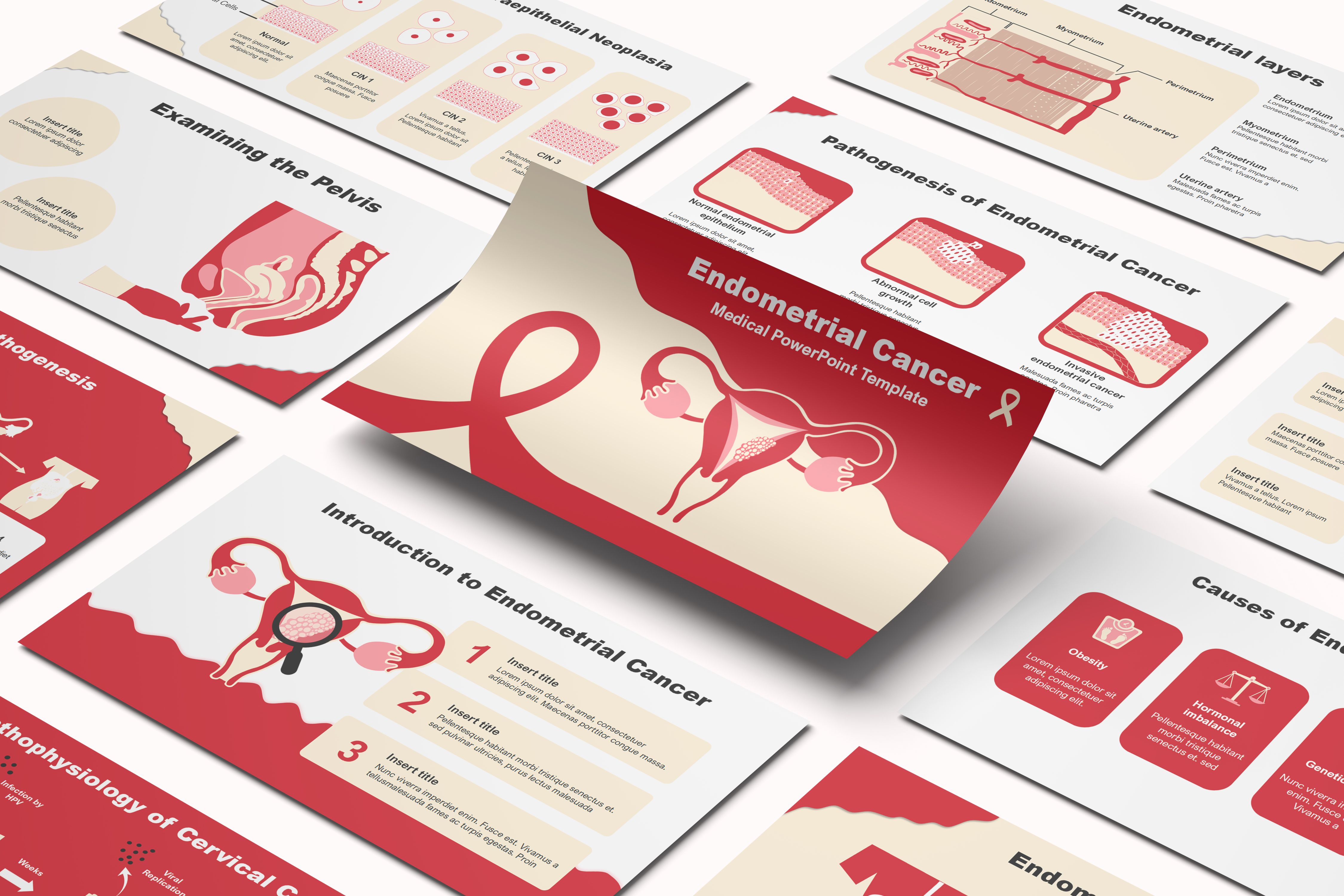 Endometrial Cancer PowerPoint Template