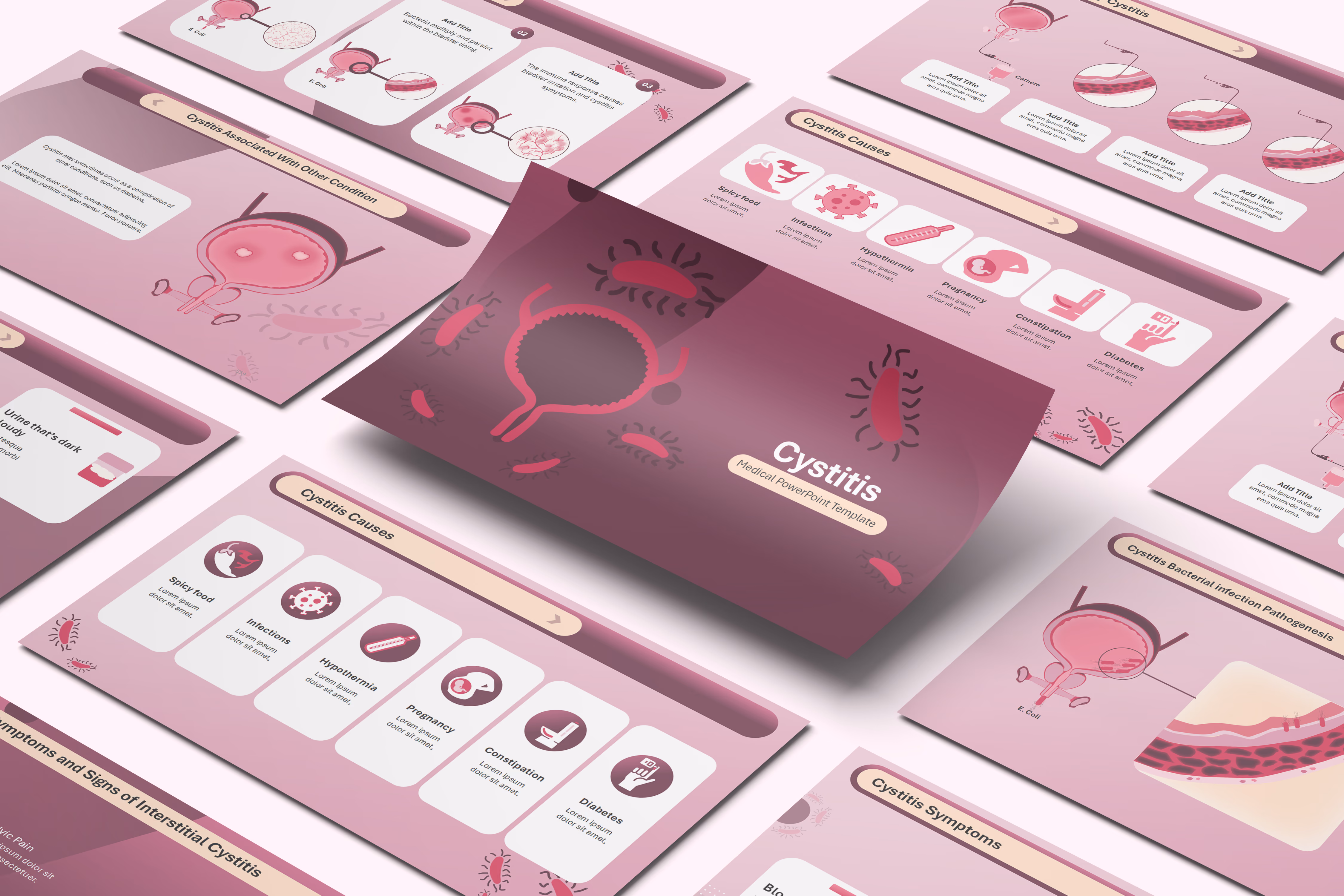 Cystitis PowerPoint Template
