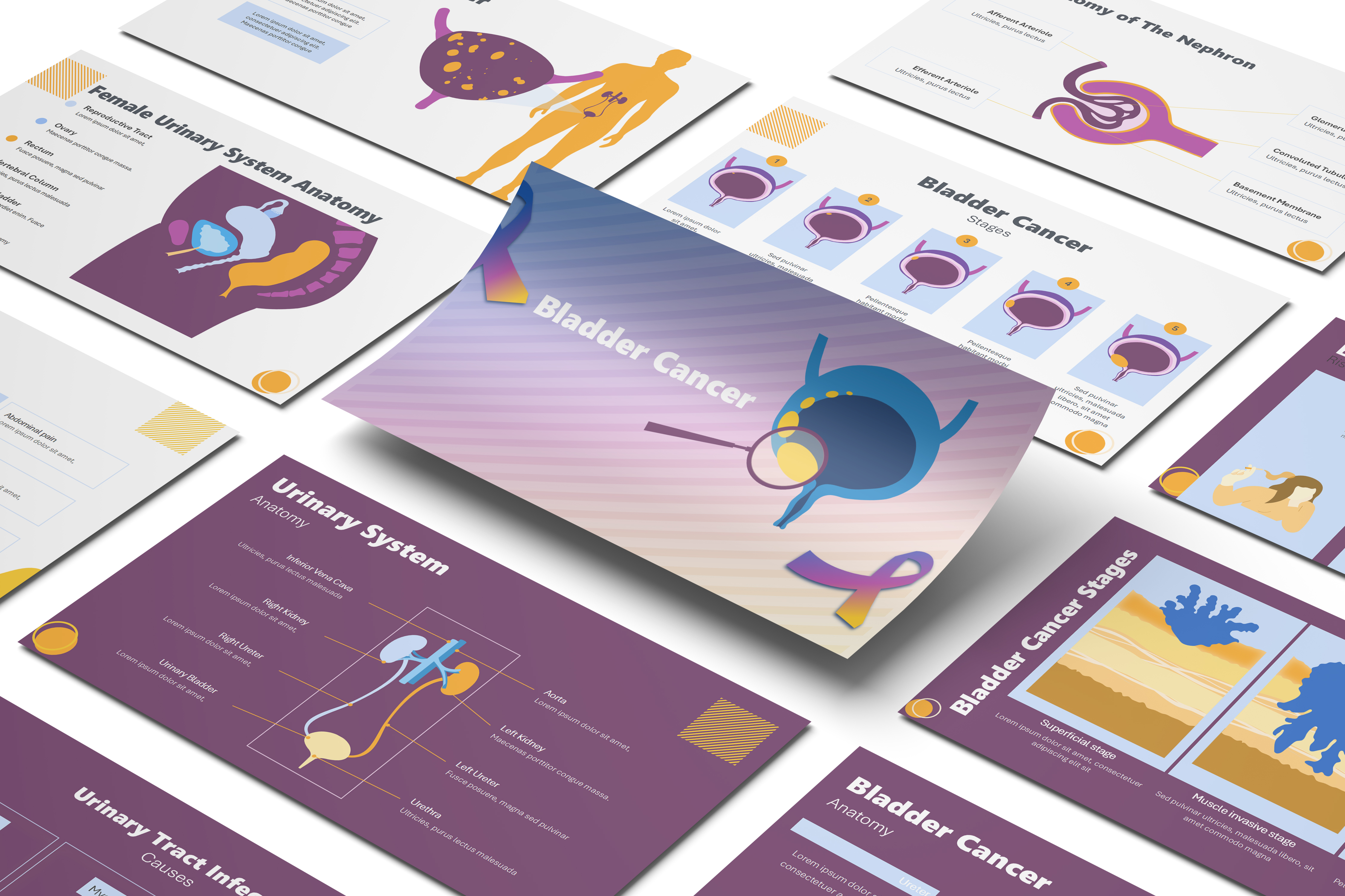 Bladder Cancer PowerPoint Template