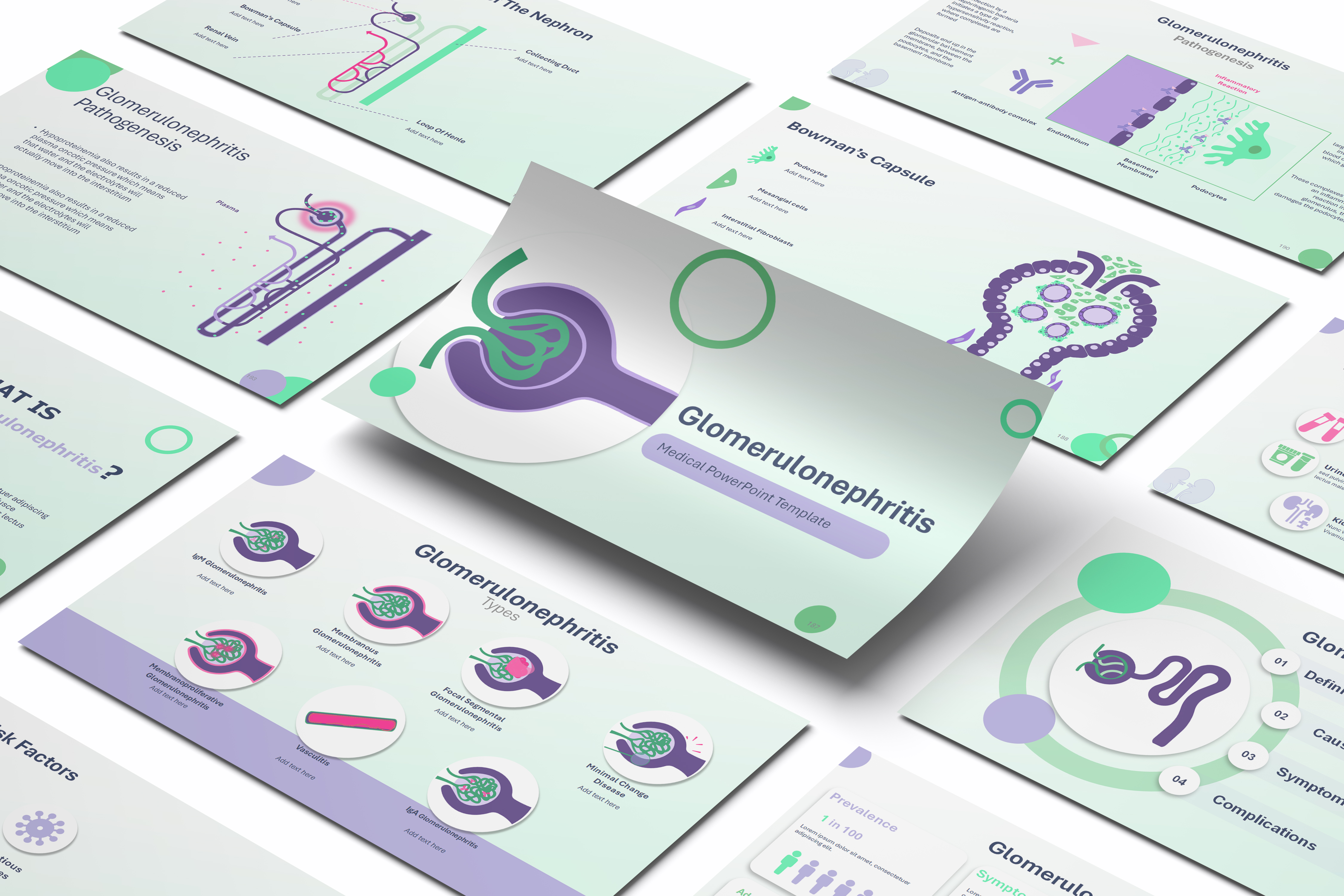 Glomerulonephritis PowerPoint Template