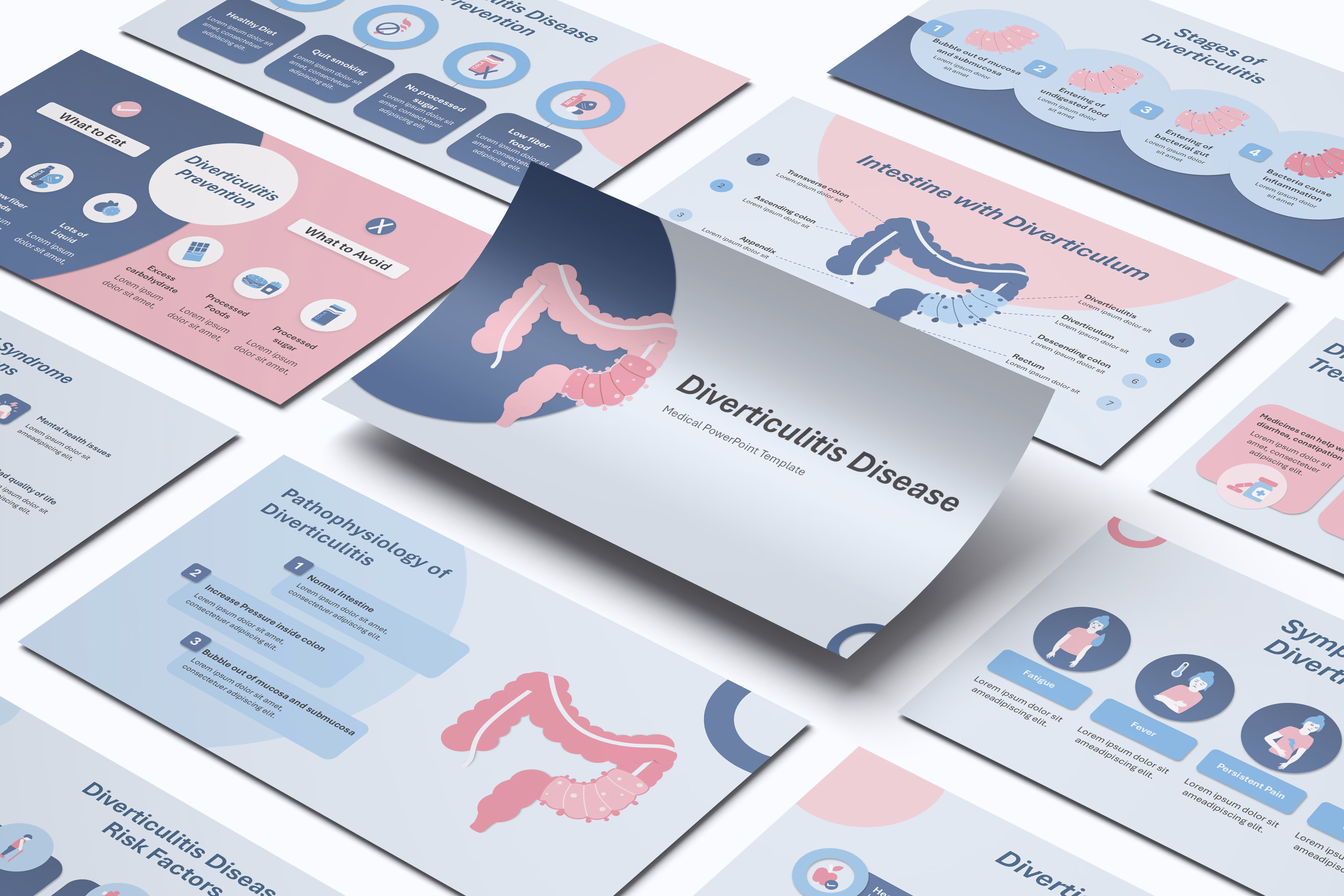 Diverticulitis PowerPoint Template