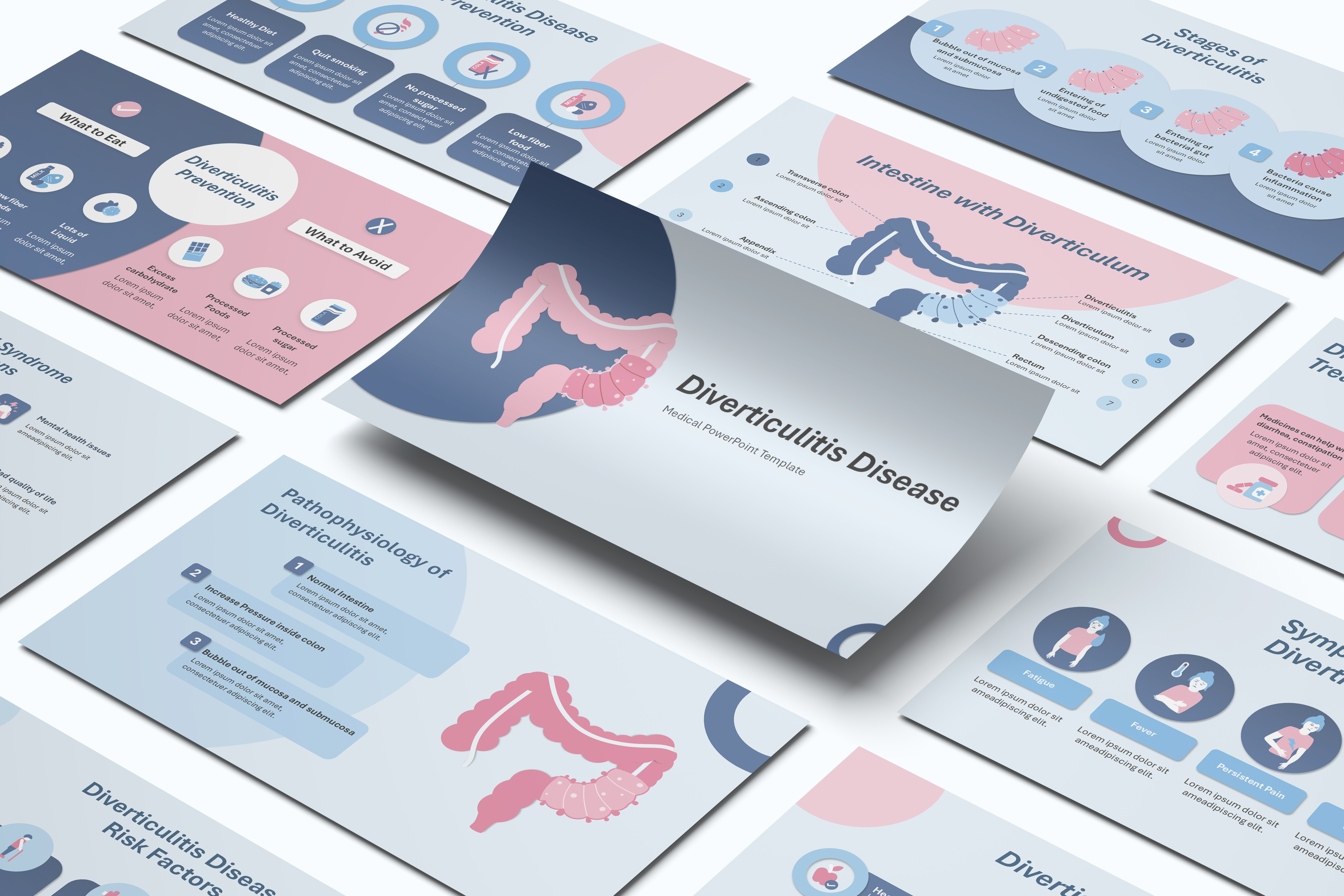Diverticulitis PowerPoint Template