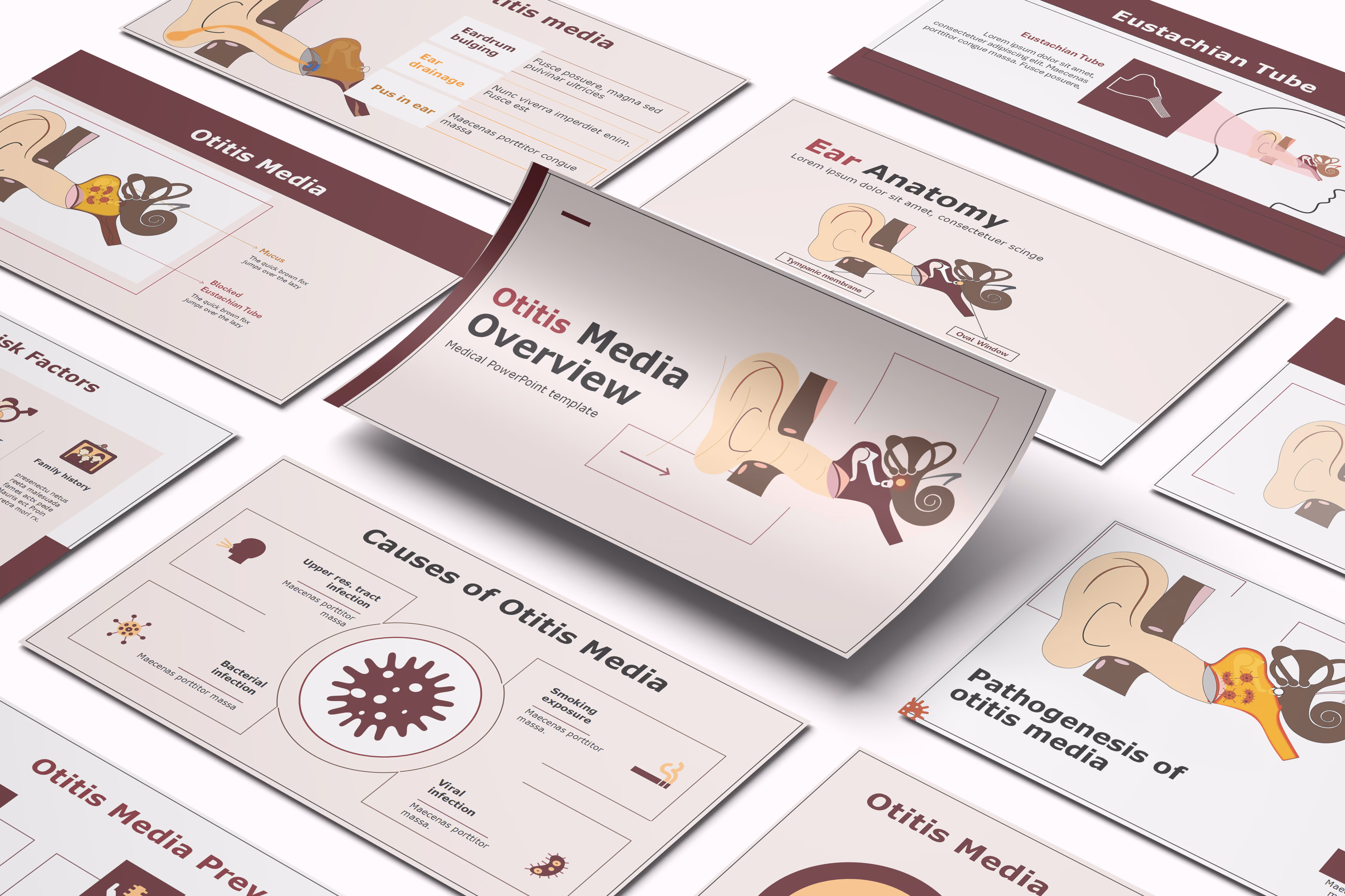 Otitis Media Overview PowerPoint Template