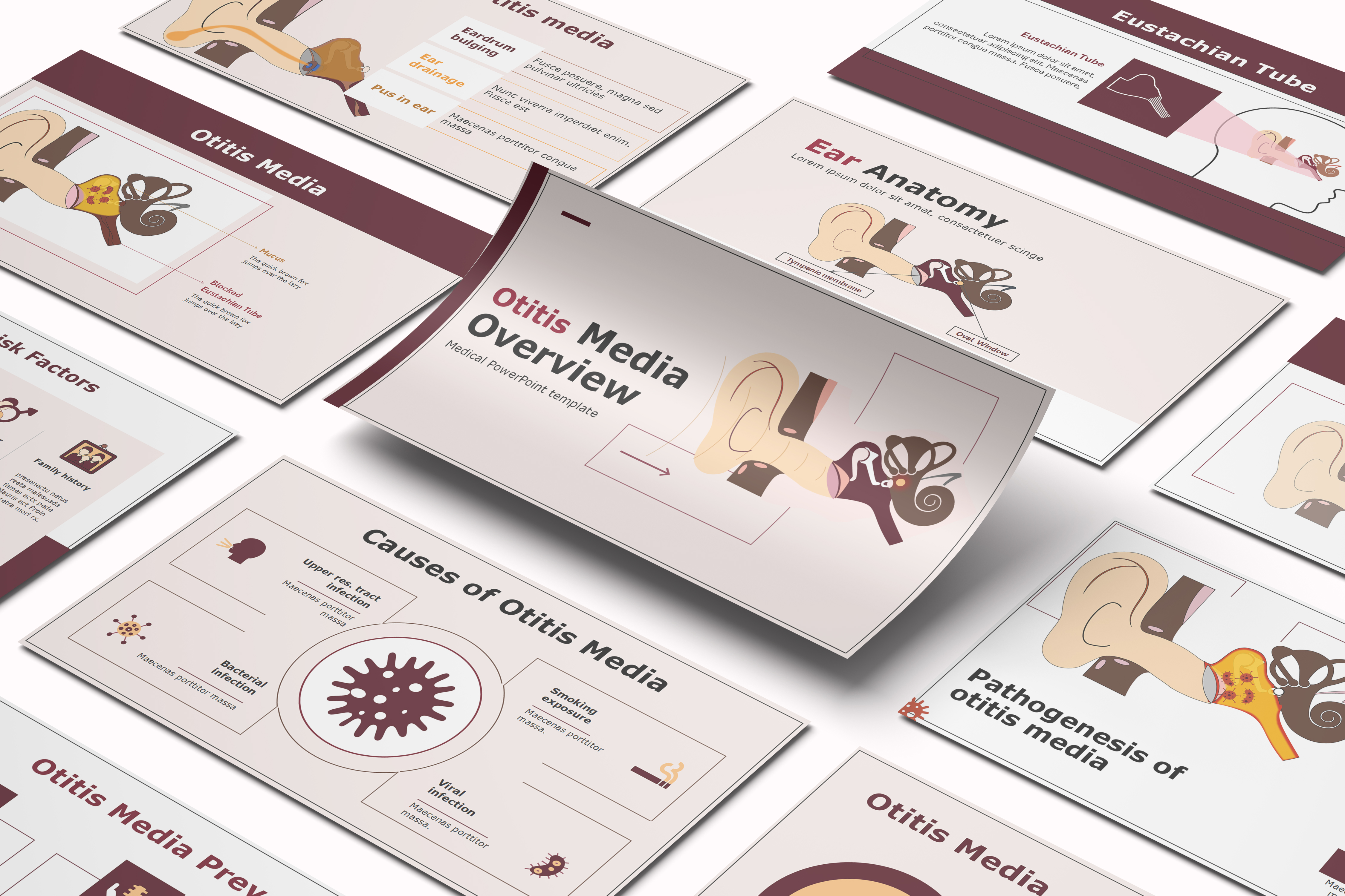Otitis Media Overview PowerPoint Template