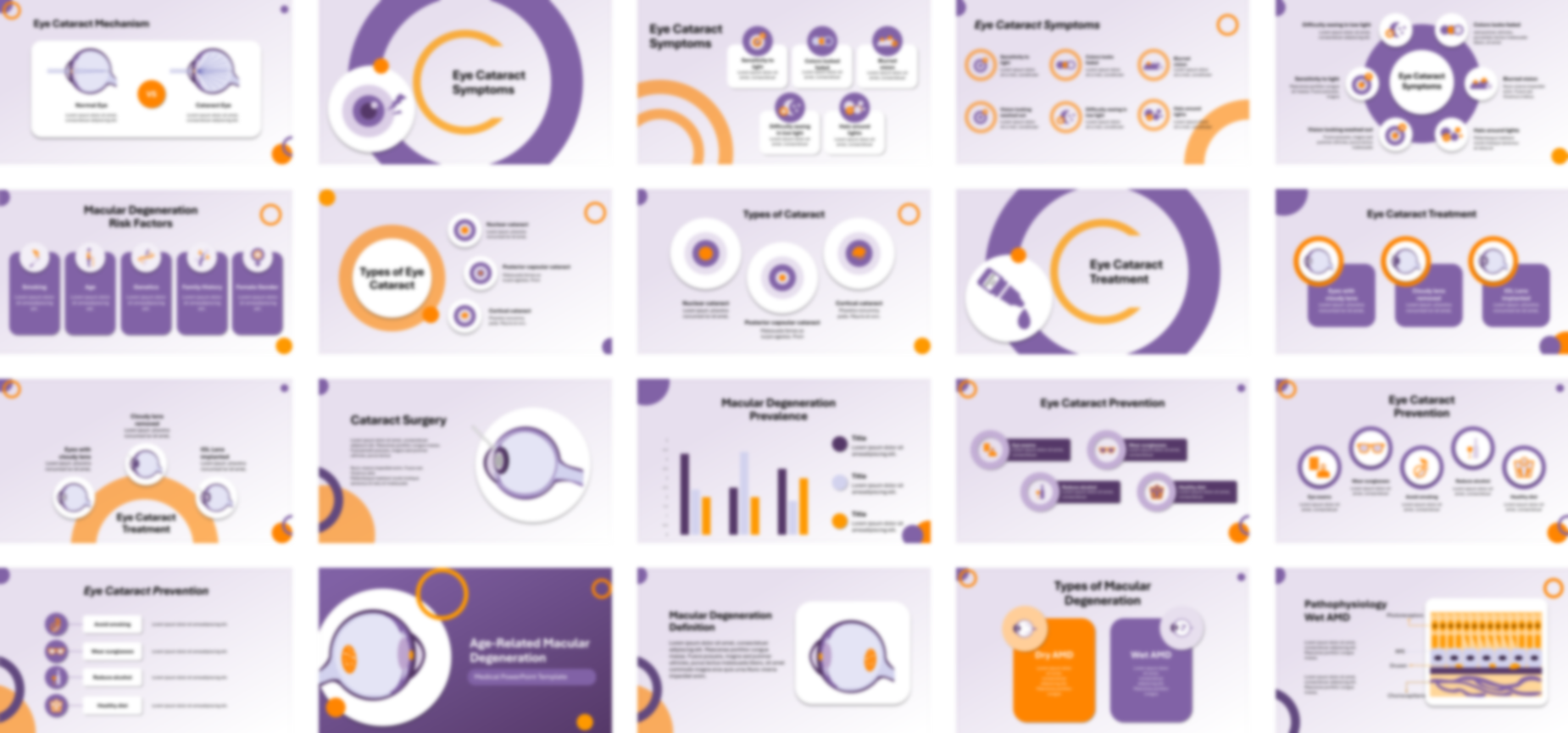 Cataracts presentation Template preview