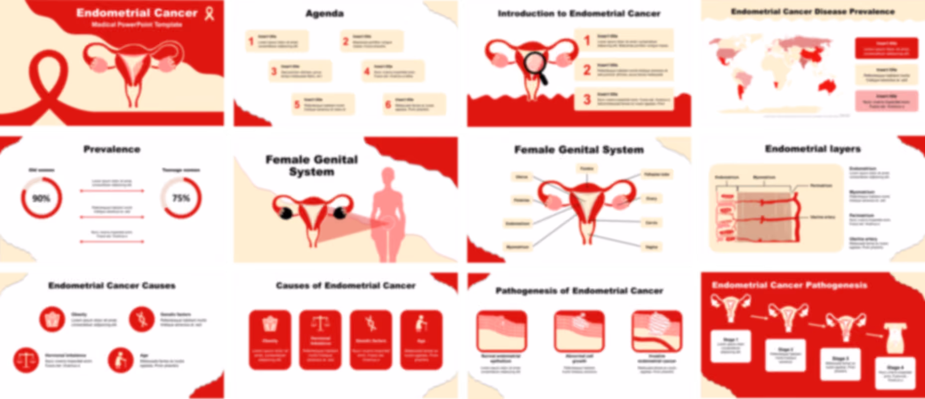 Endometrial Cancer PowerPoint Template slide preview
