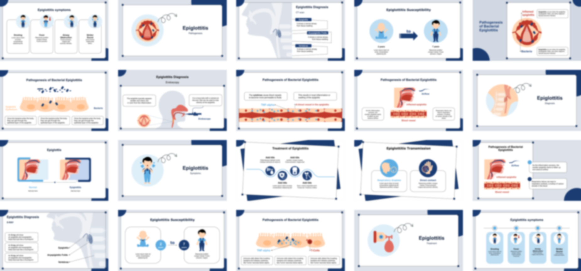 Epiglottitis presentation Template preview