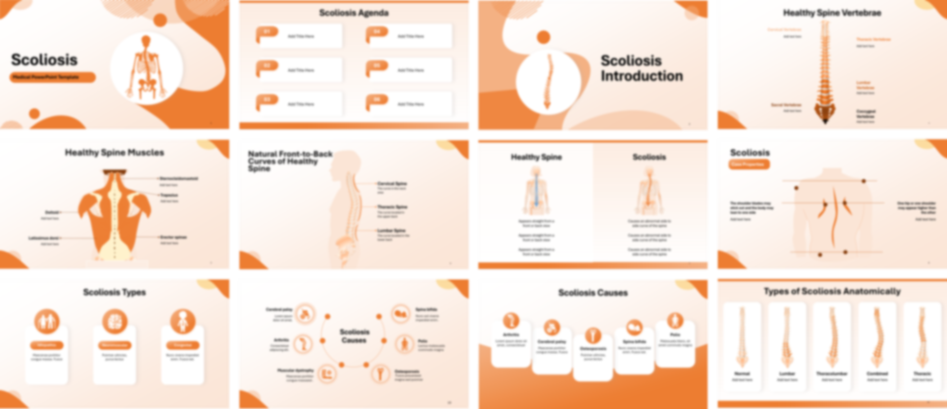 Scoliosis PowerPoint Template slide preview