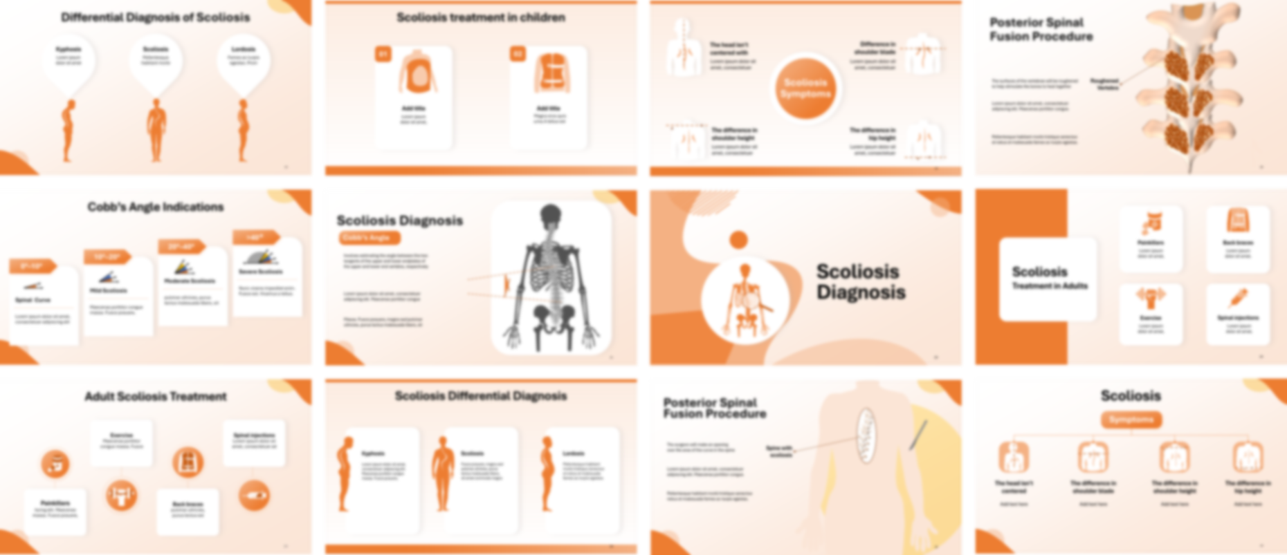 Scoliosis presentation Template preview