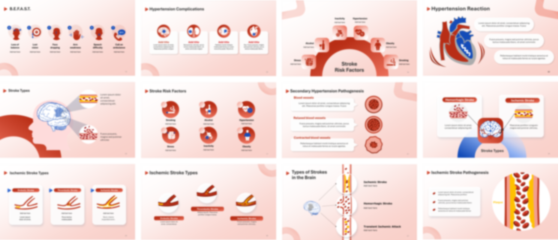 Stroke presentation Template preview