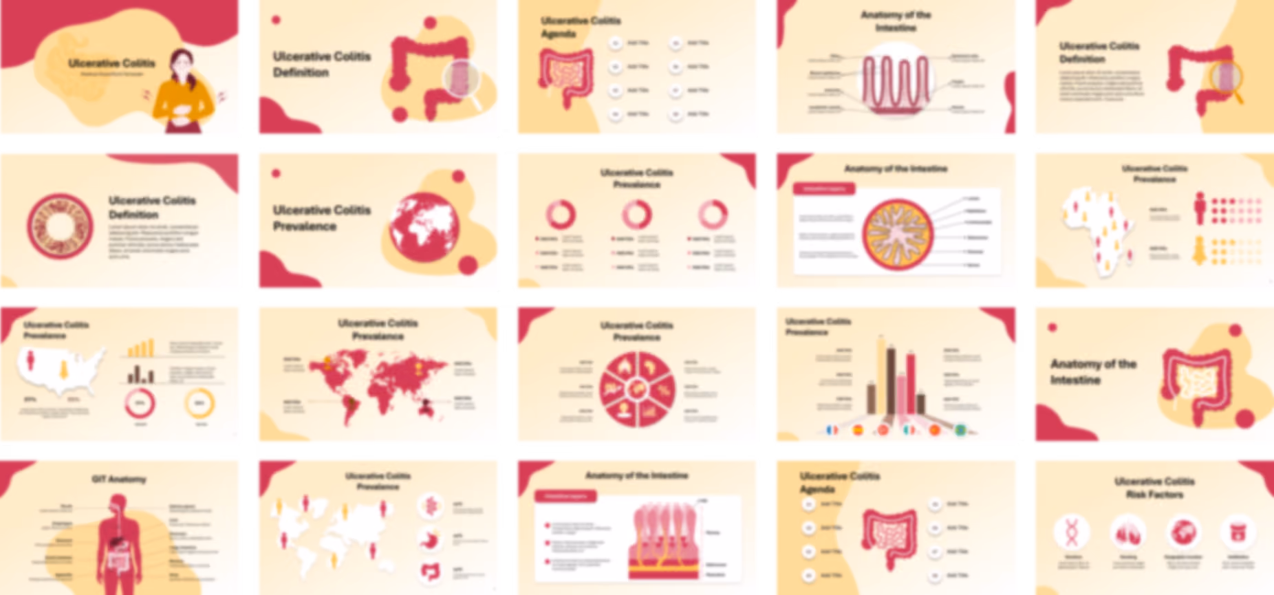 Ulcerative Colitis PowerPoint Template slide preview