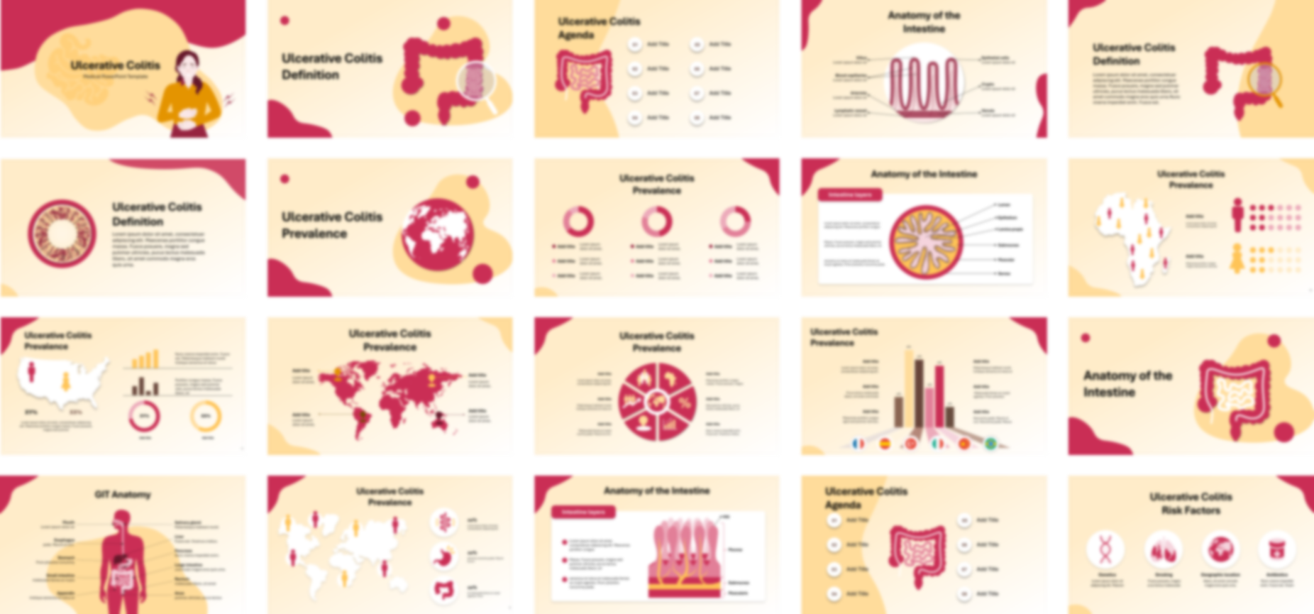 Ulcerative Colitis PowerPoint Template slide preview
