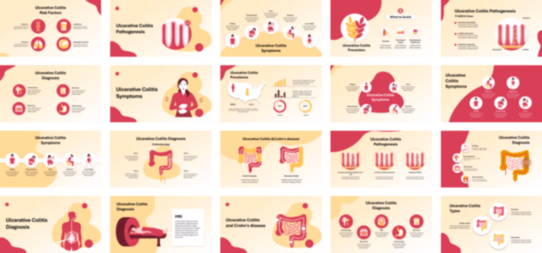 Ulcerative Colitis presentation Template preview