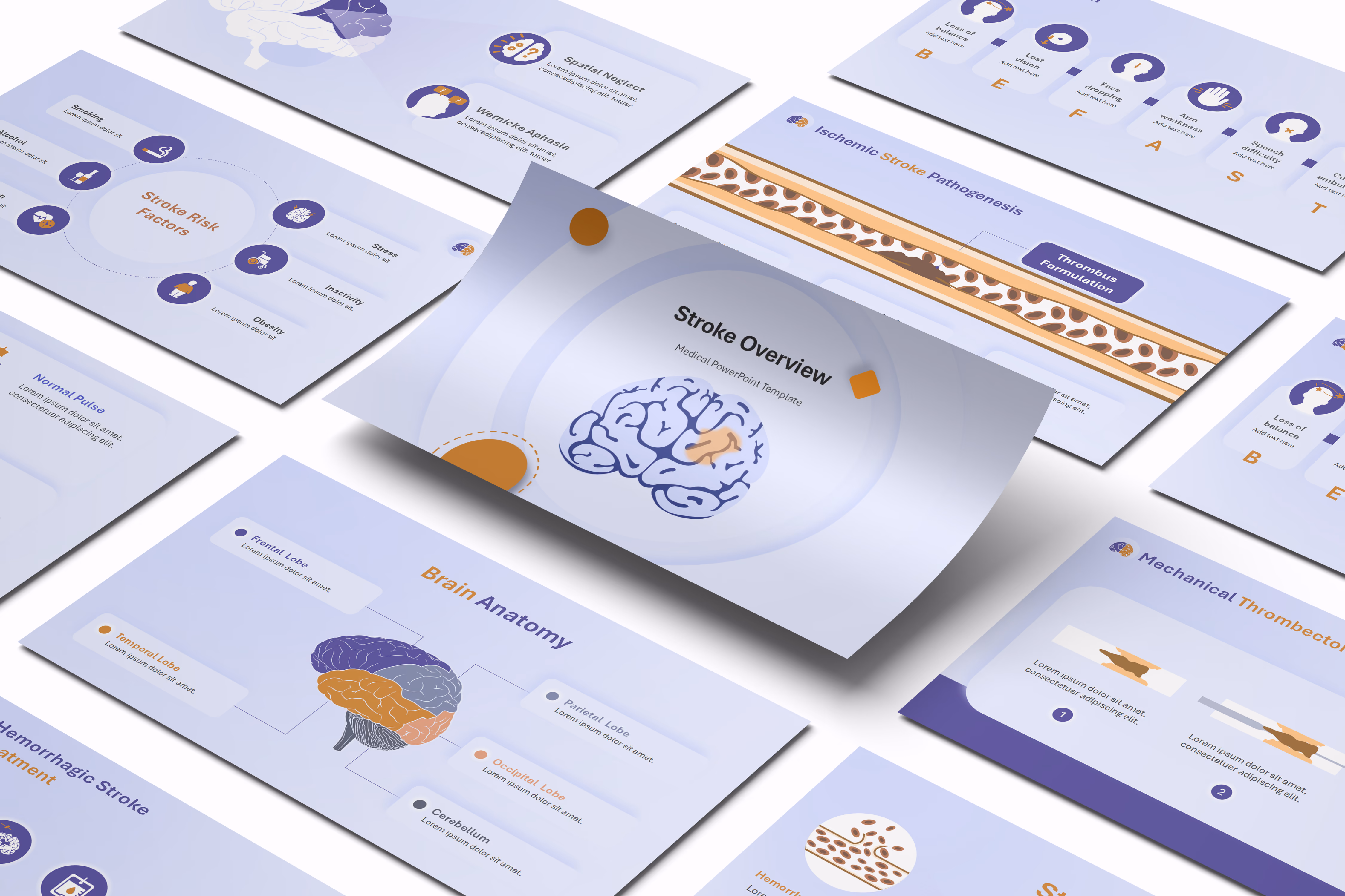 Stroke Overview Presentation Template