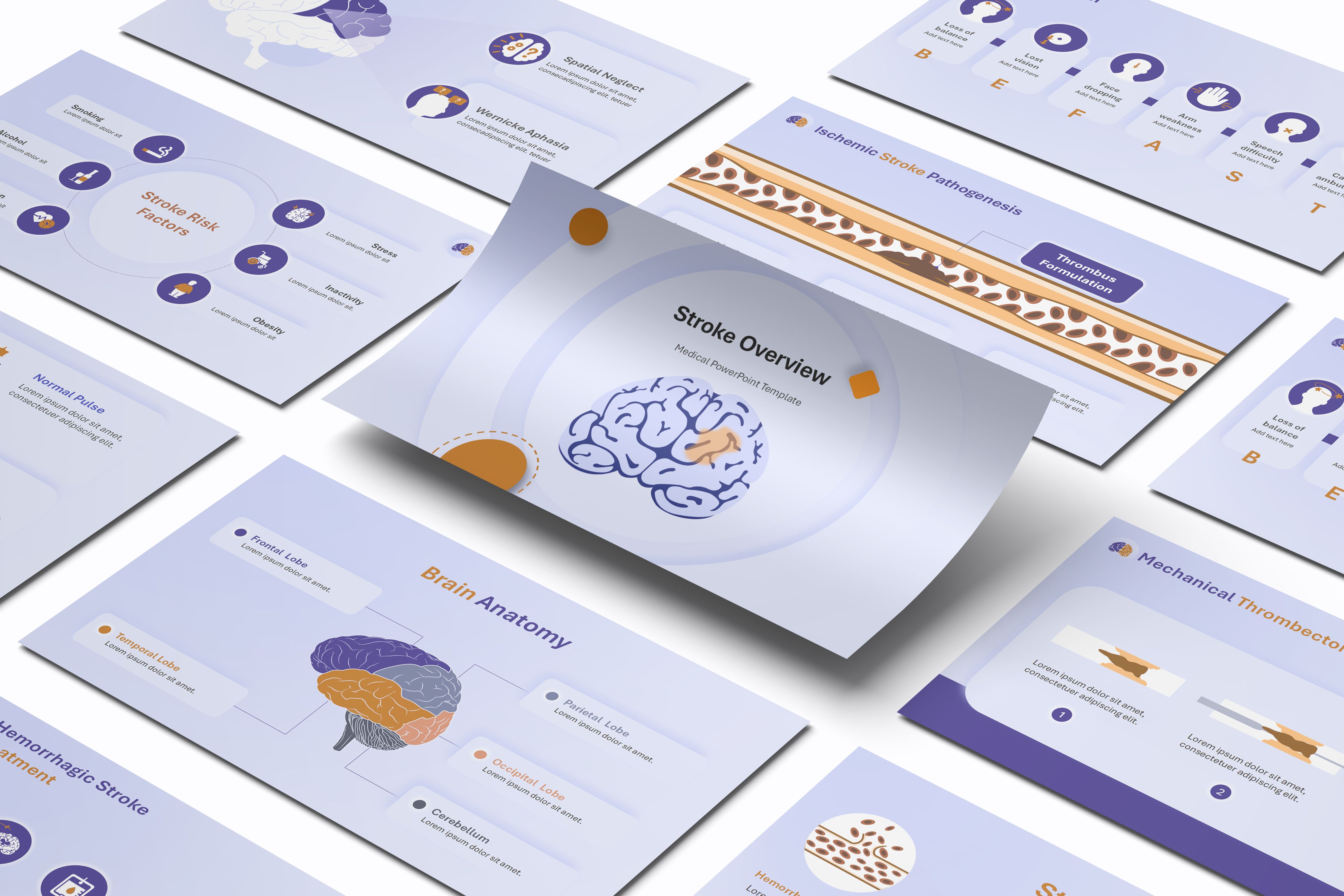 Stroke Overview Presentation Template