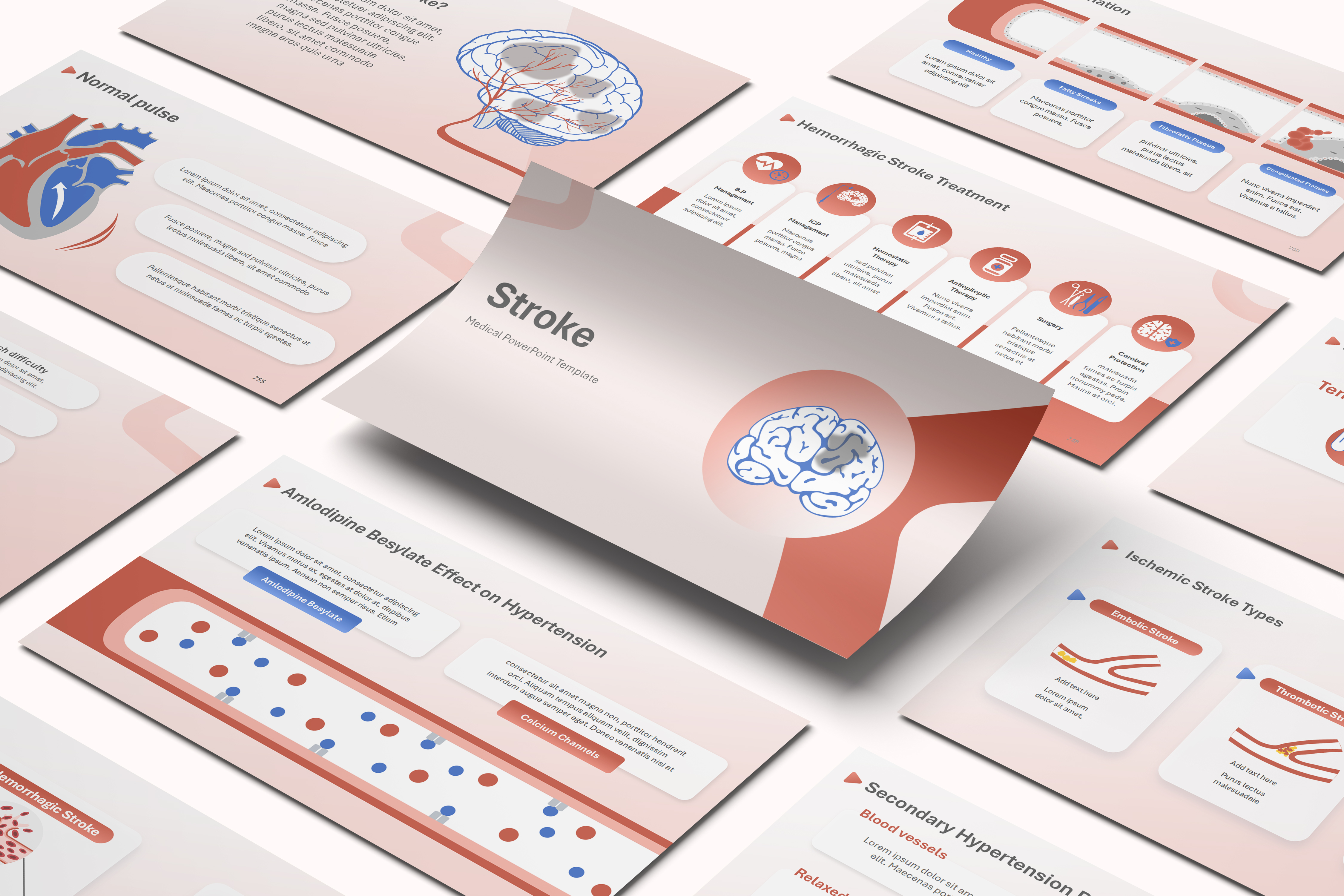 Stroke PowerPoint Template