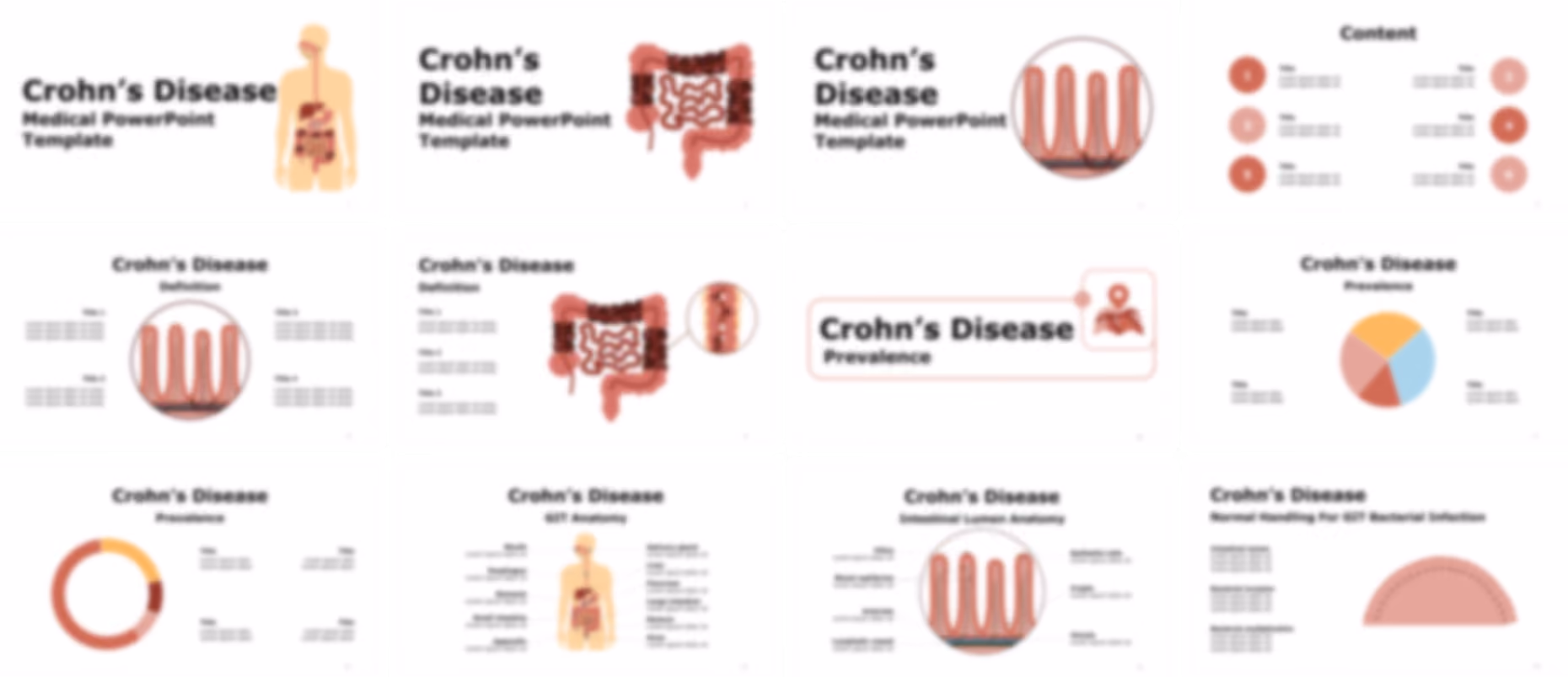 Crohn's disease PowerPoint Template slide preview