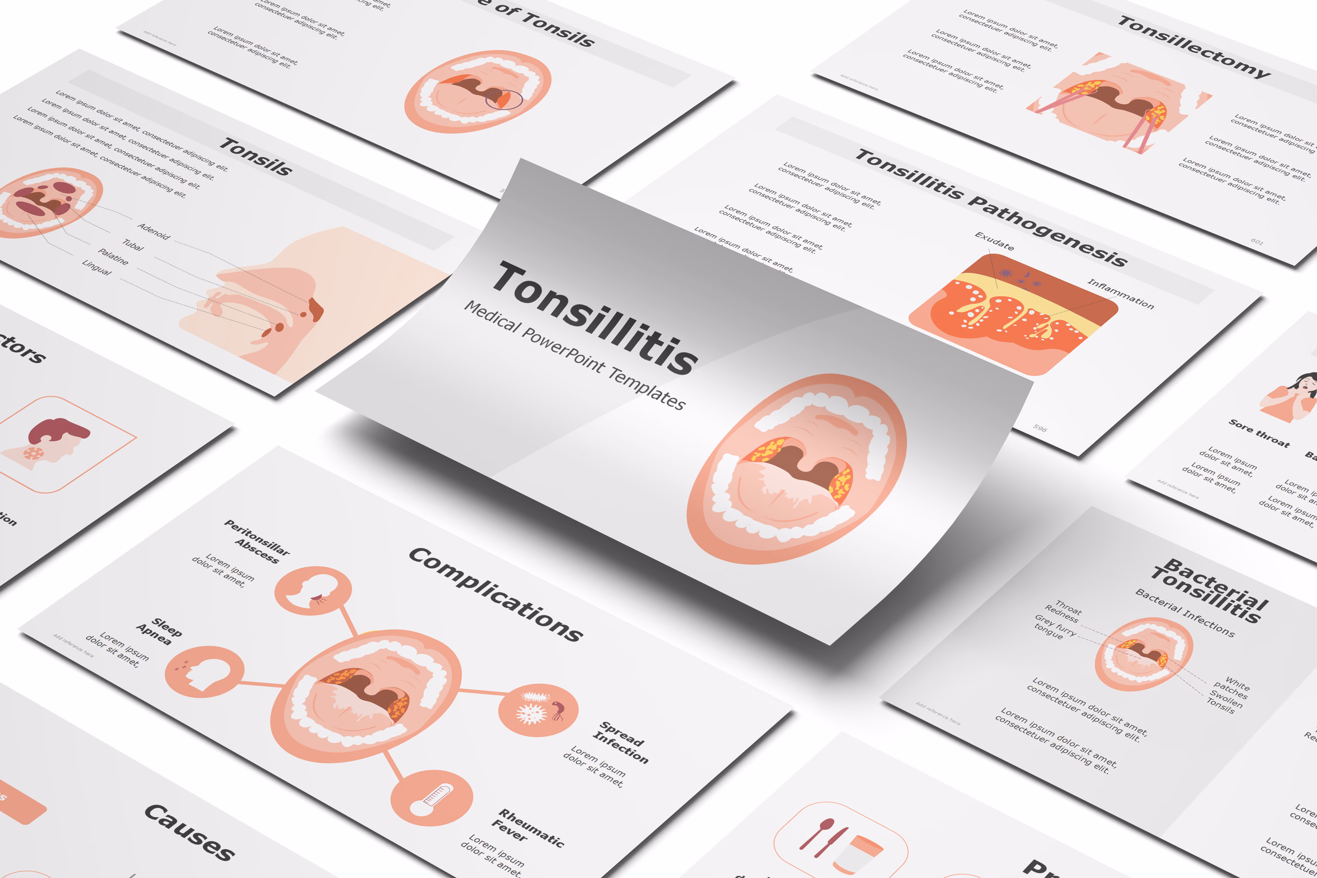 Tonsillitis PowerPoint Template