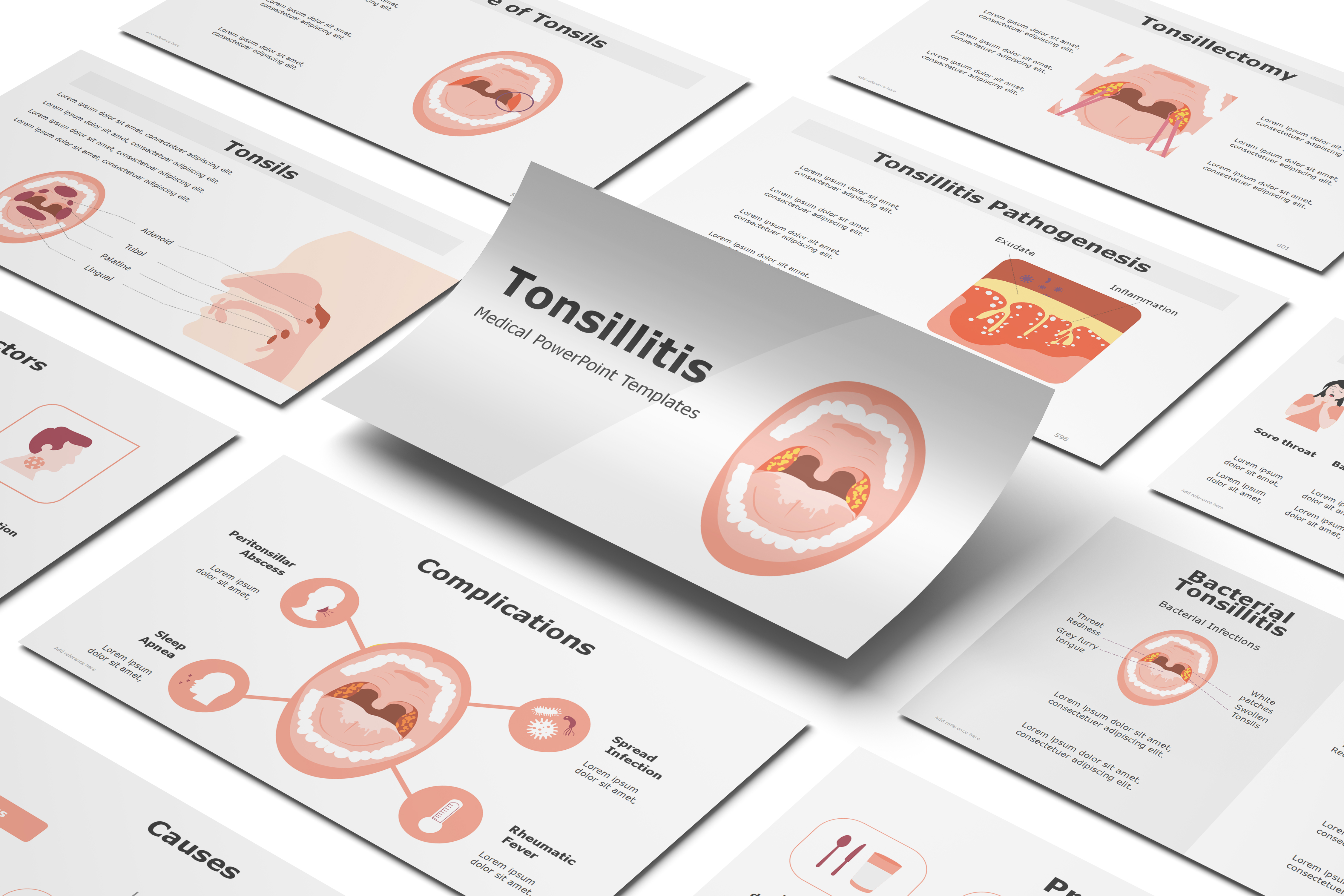 Tonsillitis PowerPoint Template