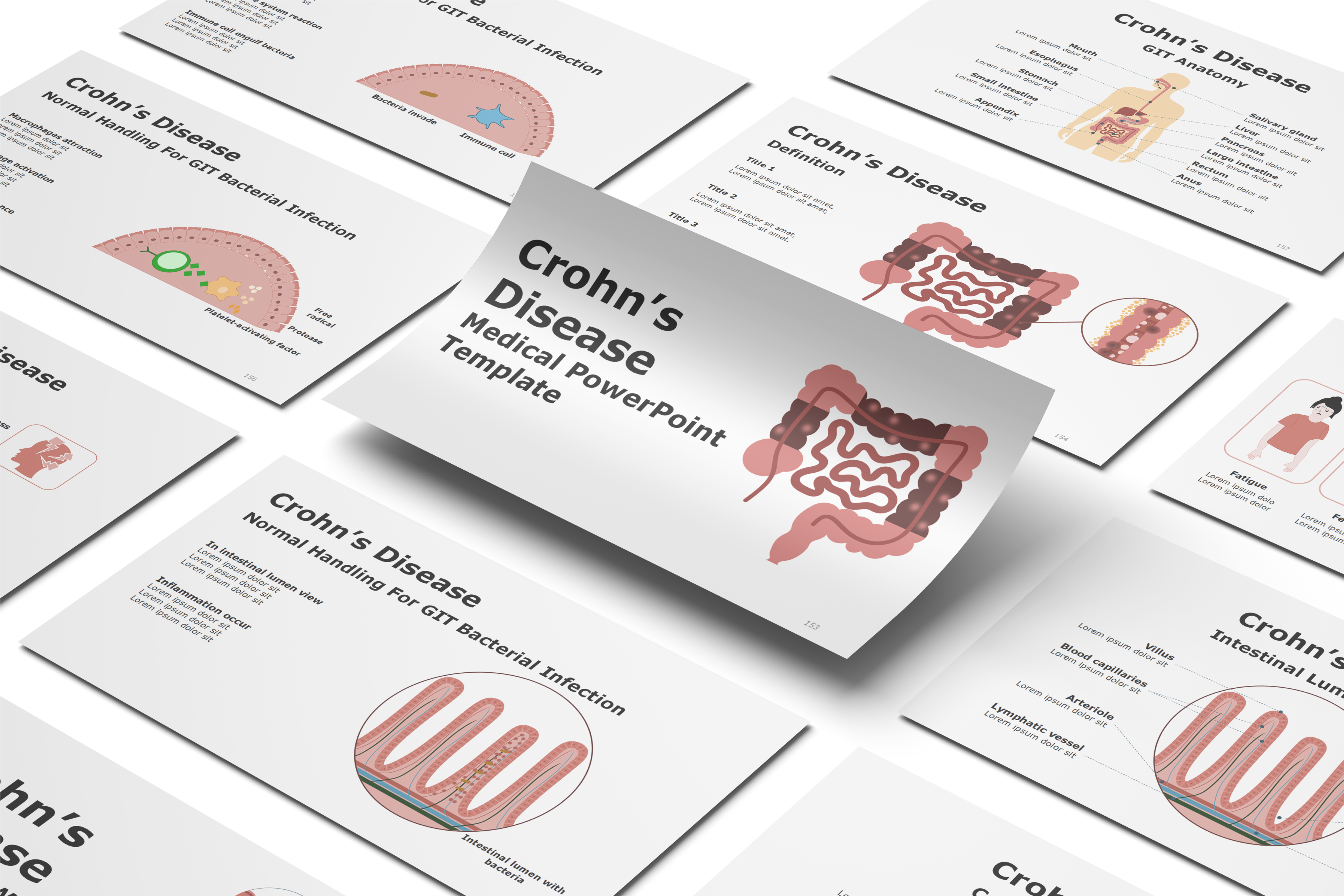 Crohn's disease PowerPoint Template
