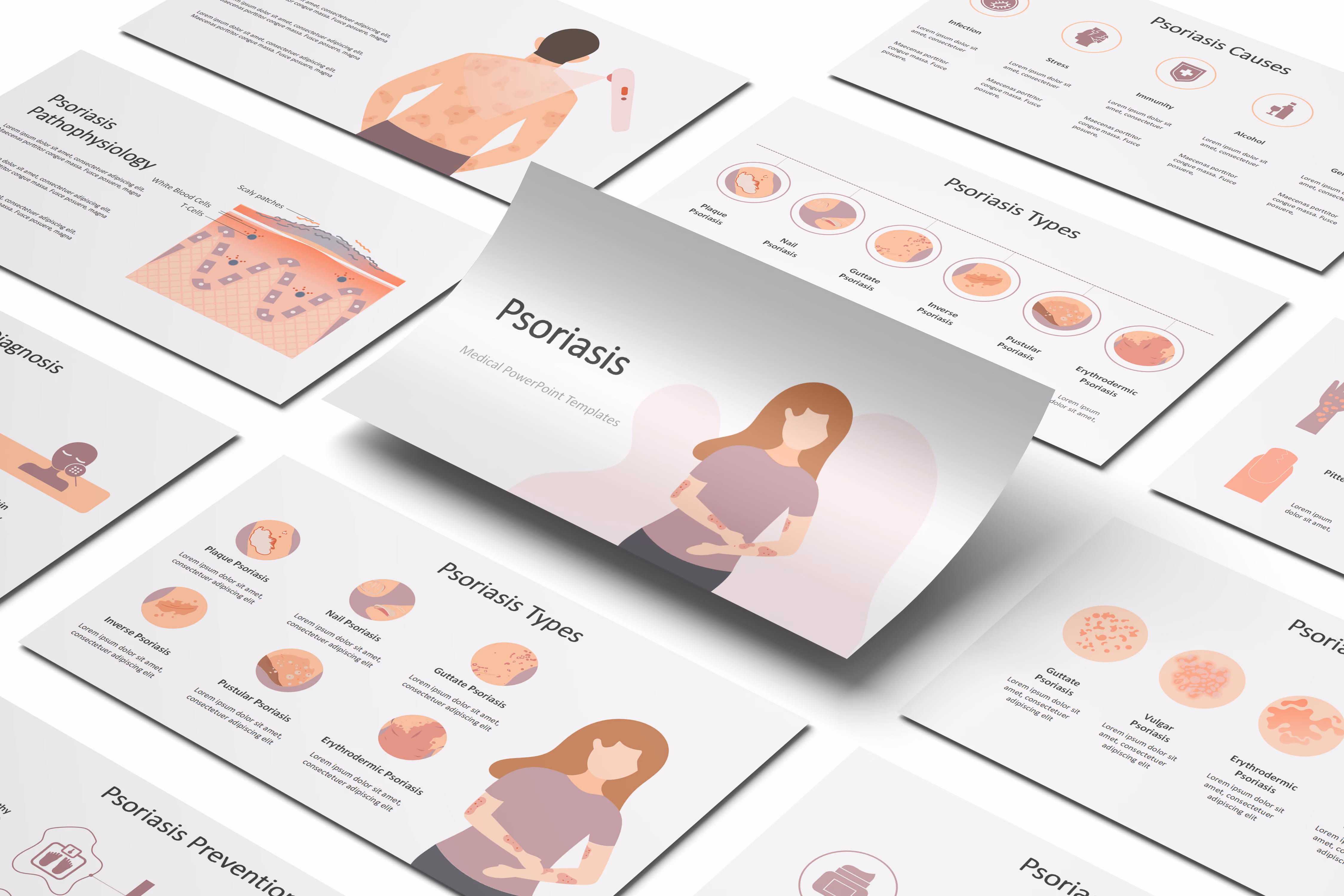 Psoriasis PowerPoint Template
