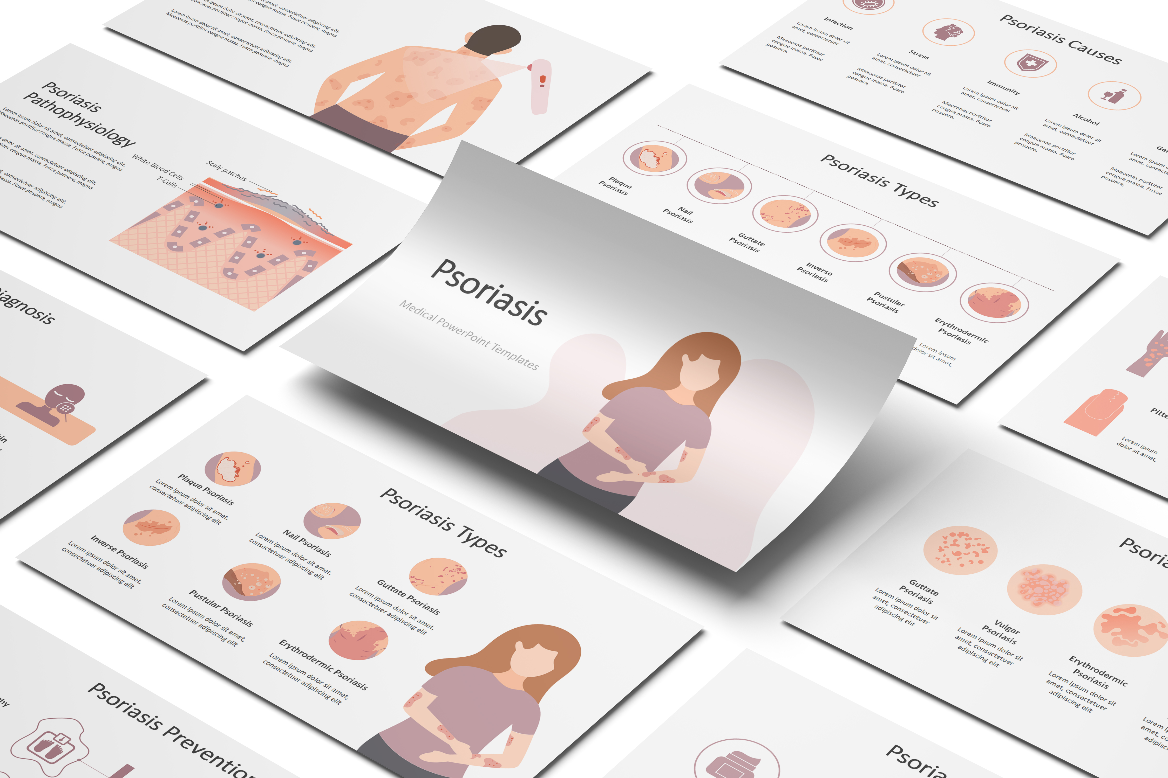 Psoriasis PowerPoint Template