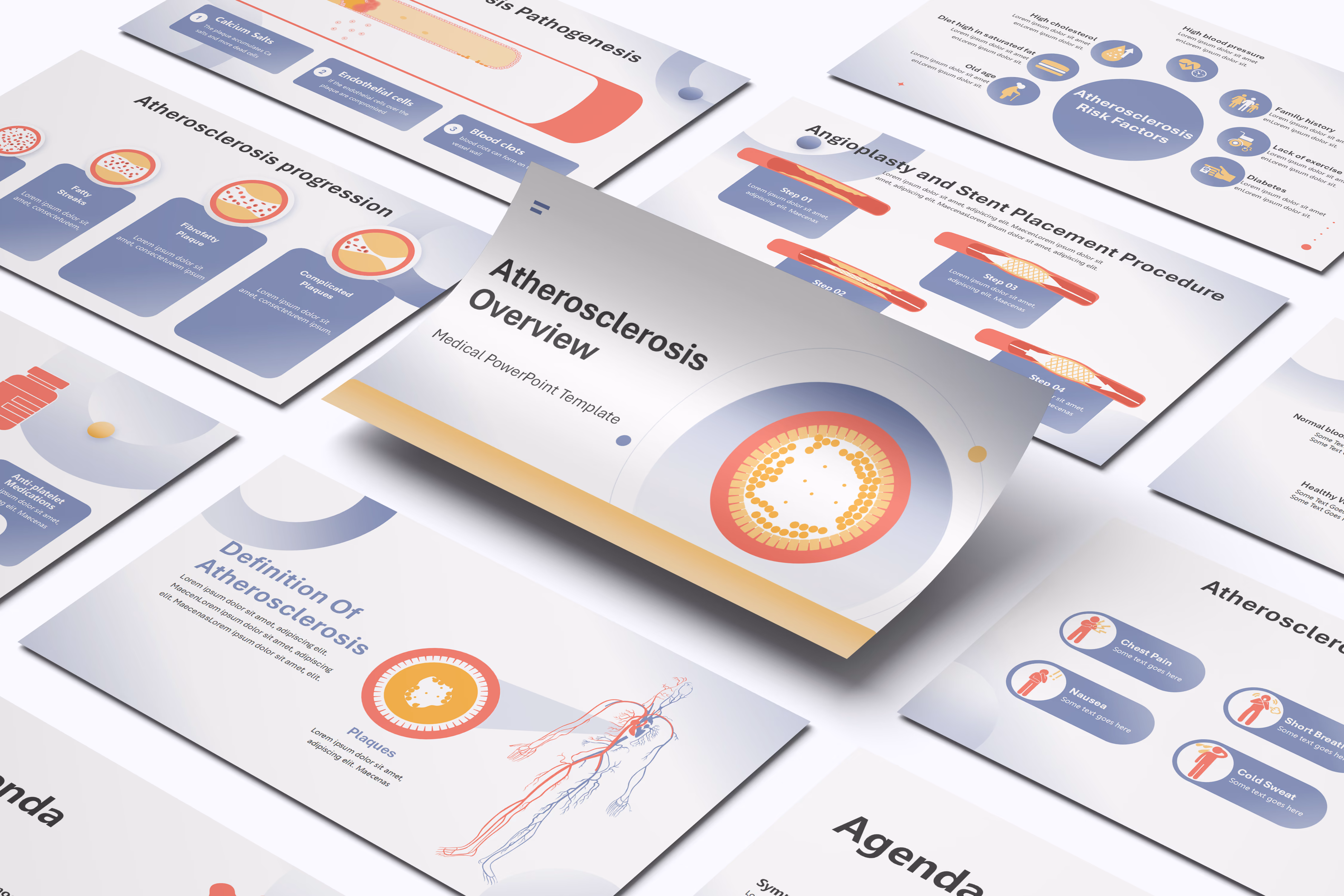 Atherosclerosis Overview PowerPoint Template