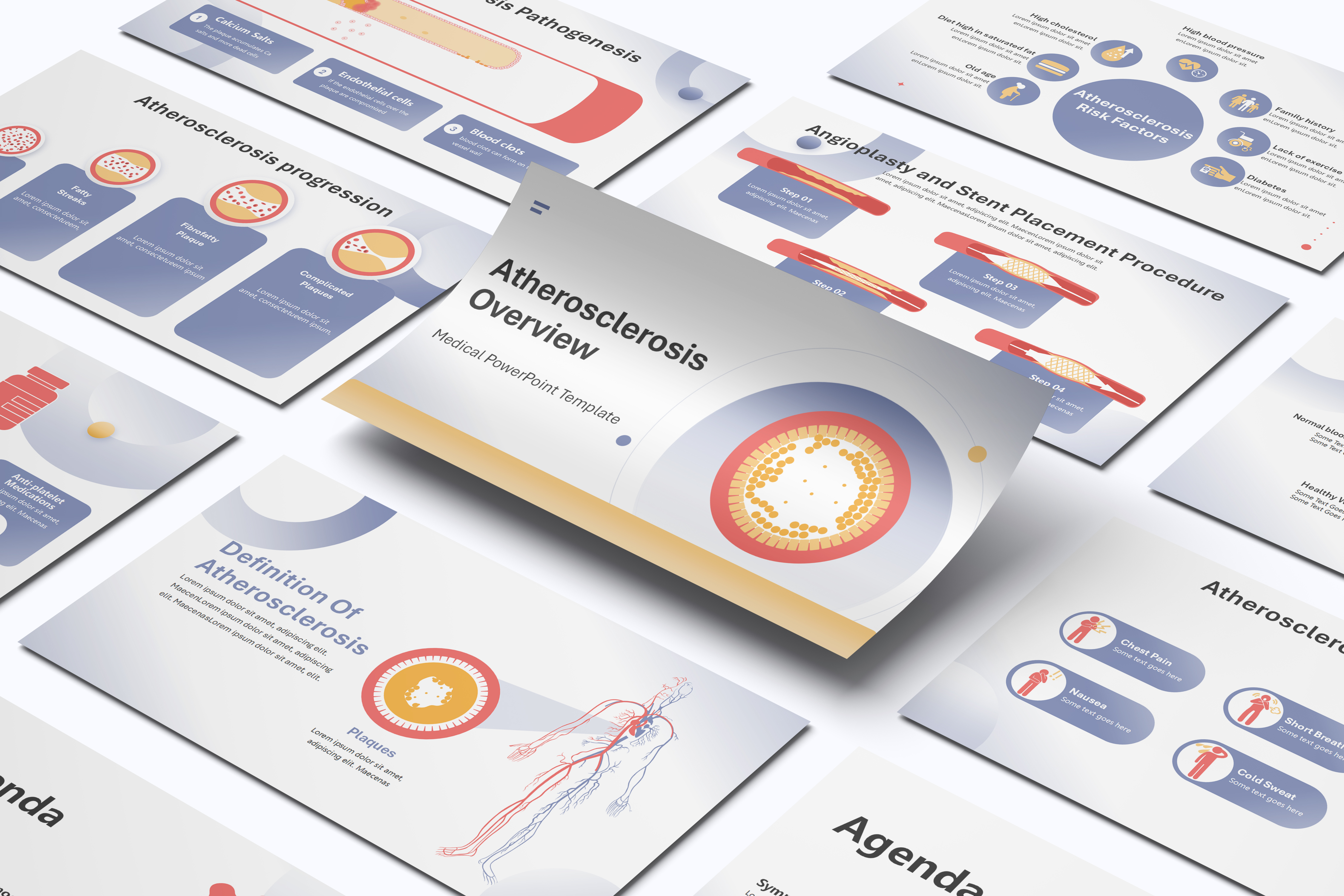 Atherosclerosis Overview PowerPoint Template