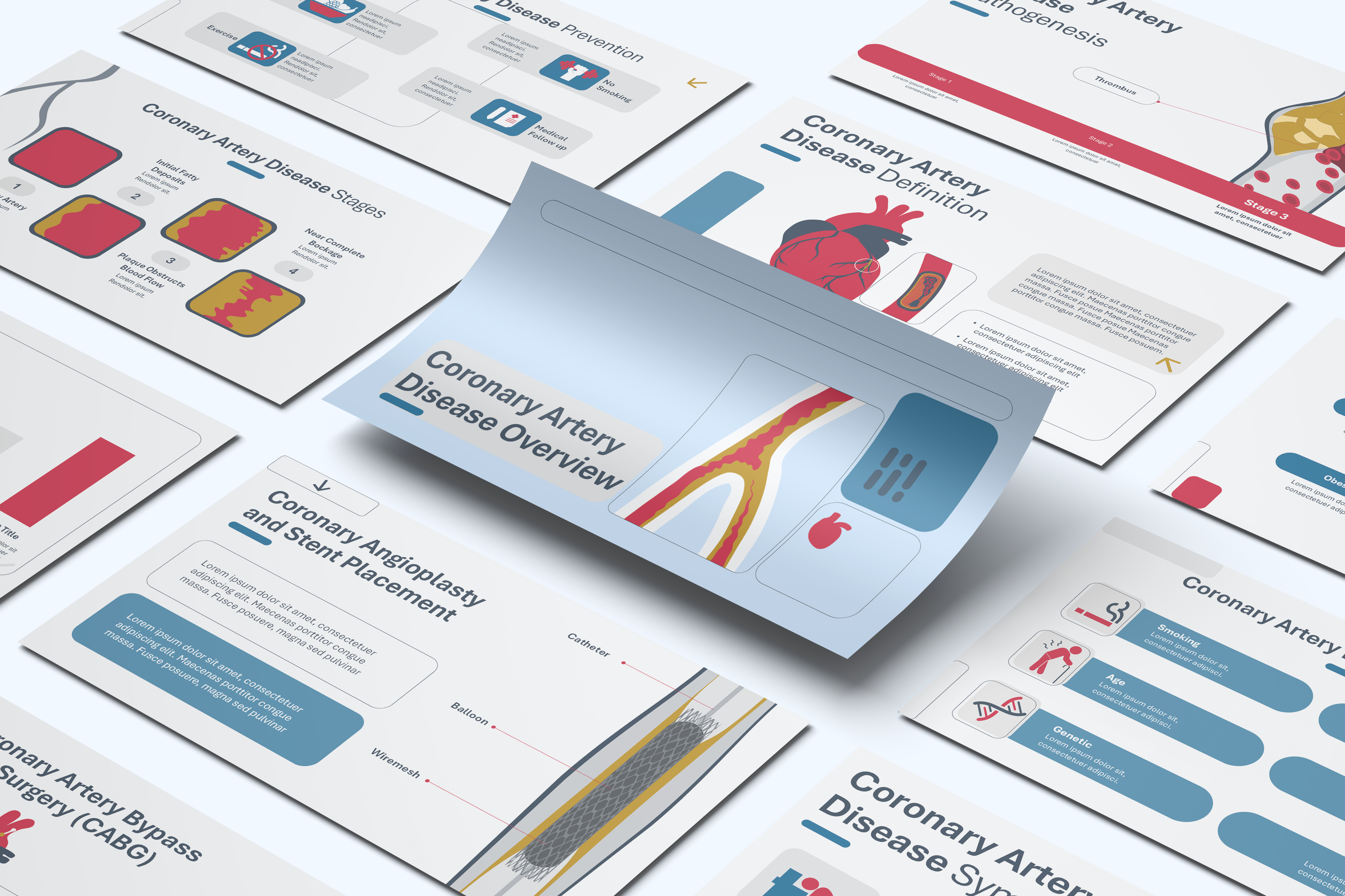 Coronary Artery Disease Overview PowerPoint Template