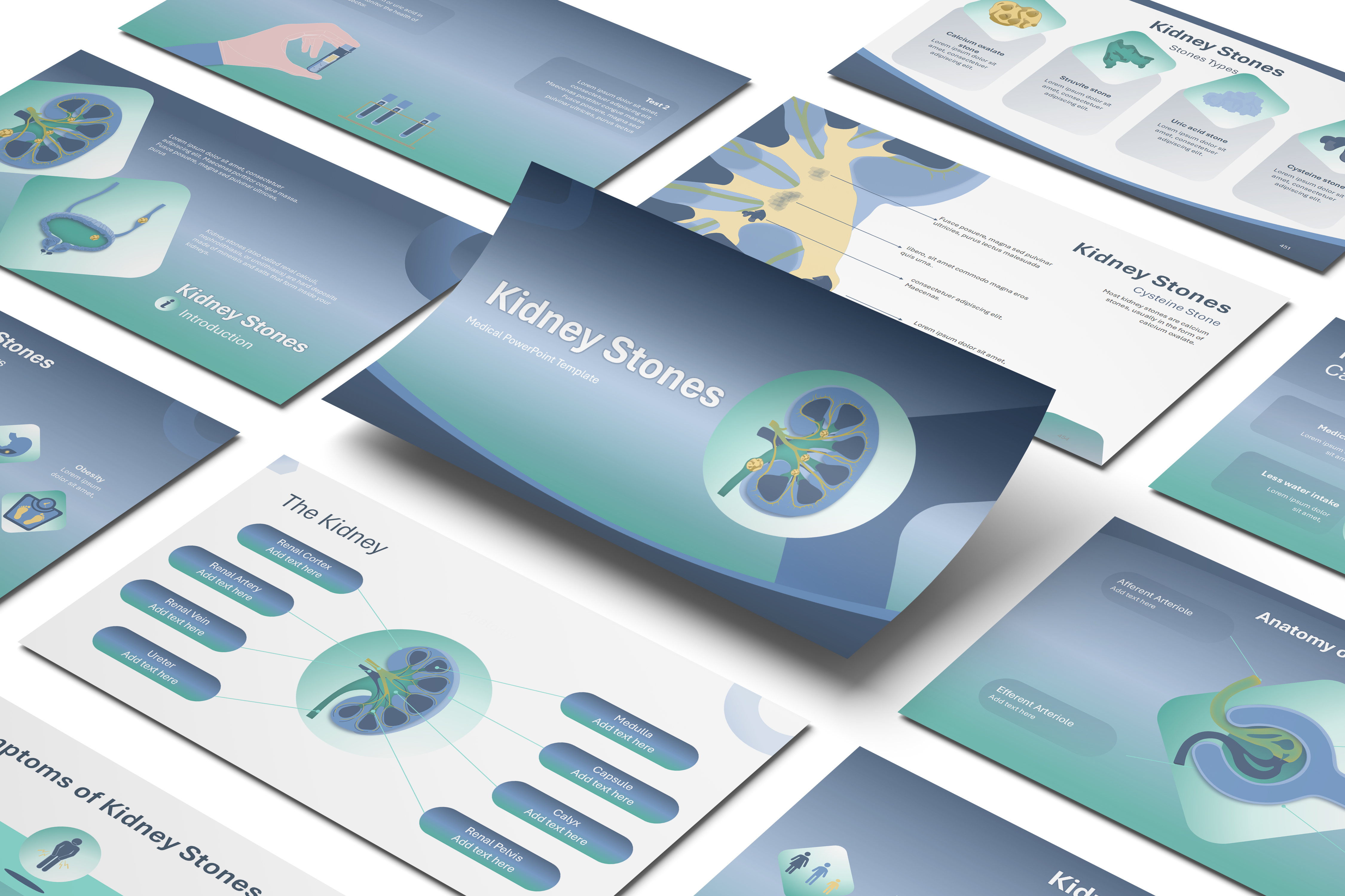 Kidney Stones PowerPoint Template