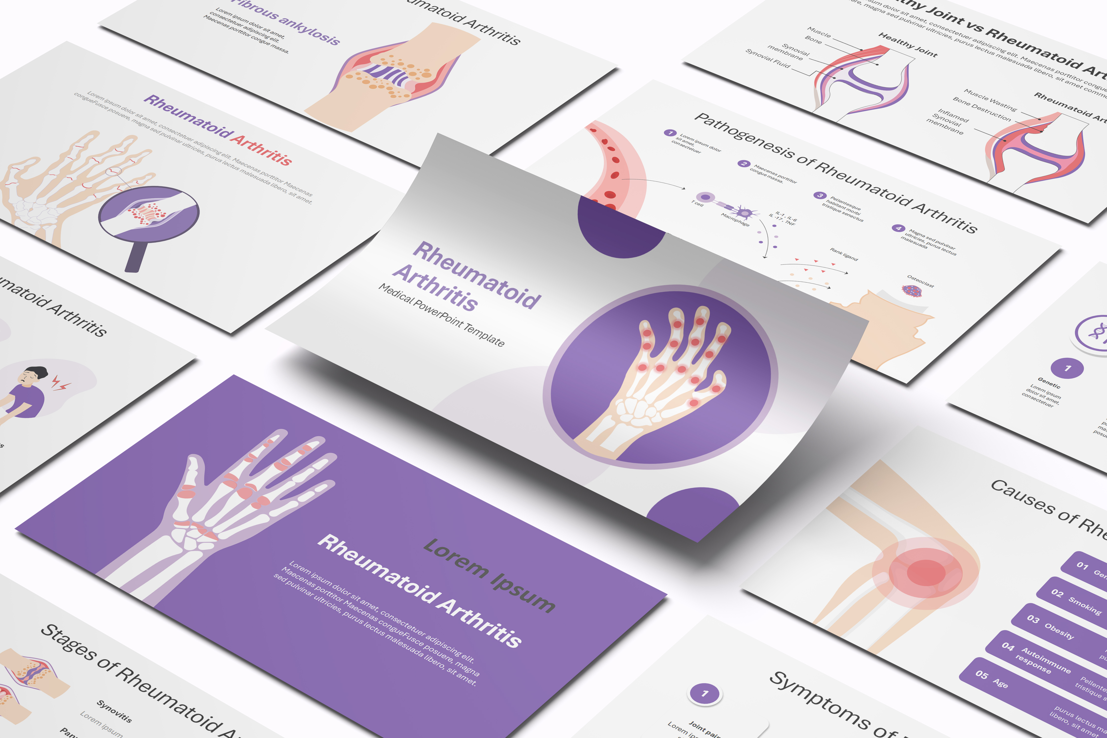 Rheumatoid Arthritis PowerPoint Template