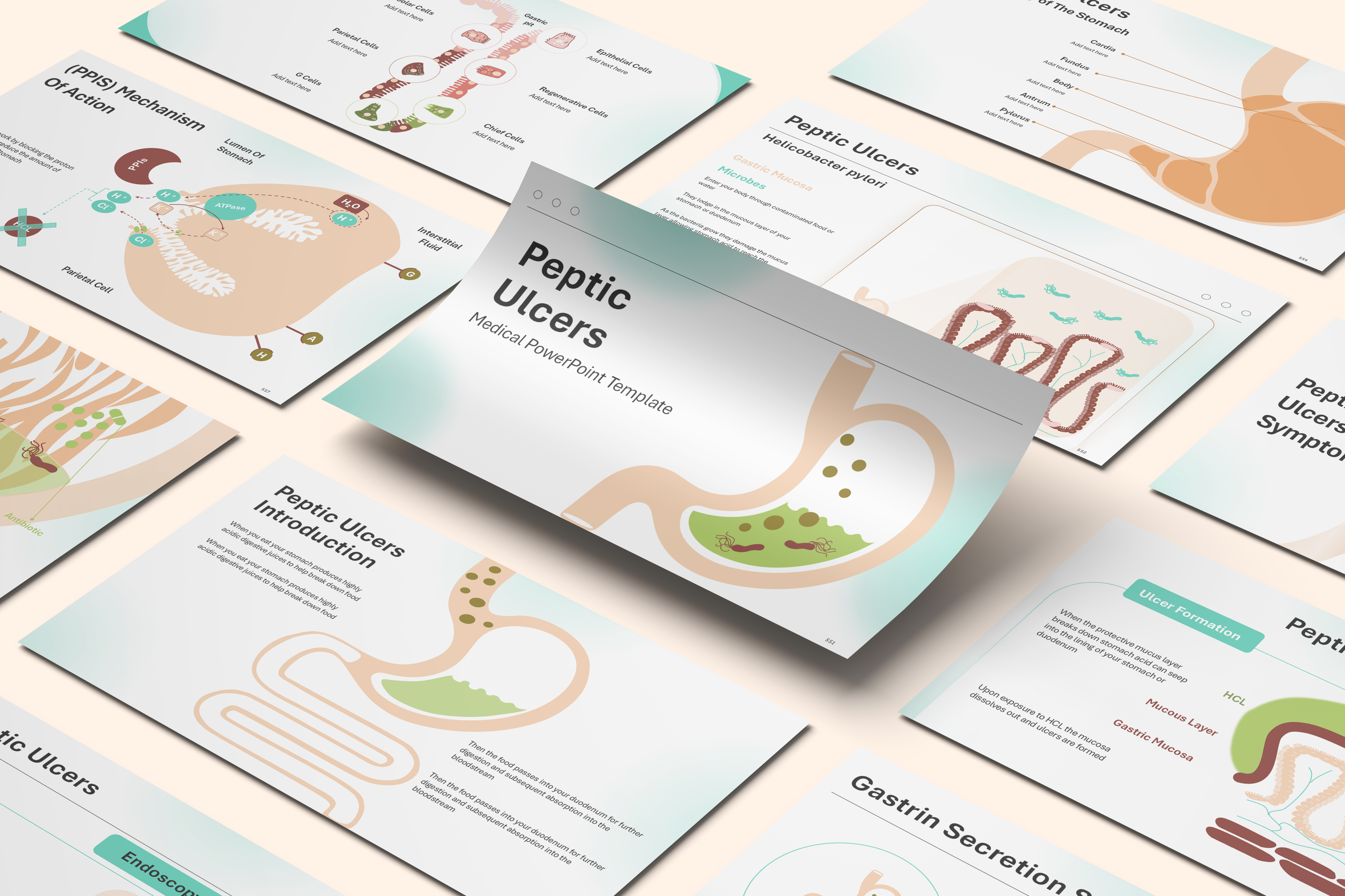 Peptic Ulcer Disease PowerPoint Template