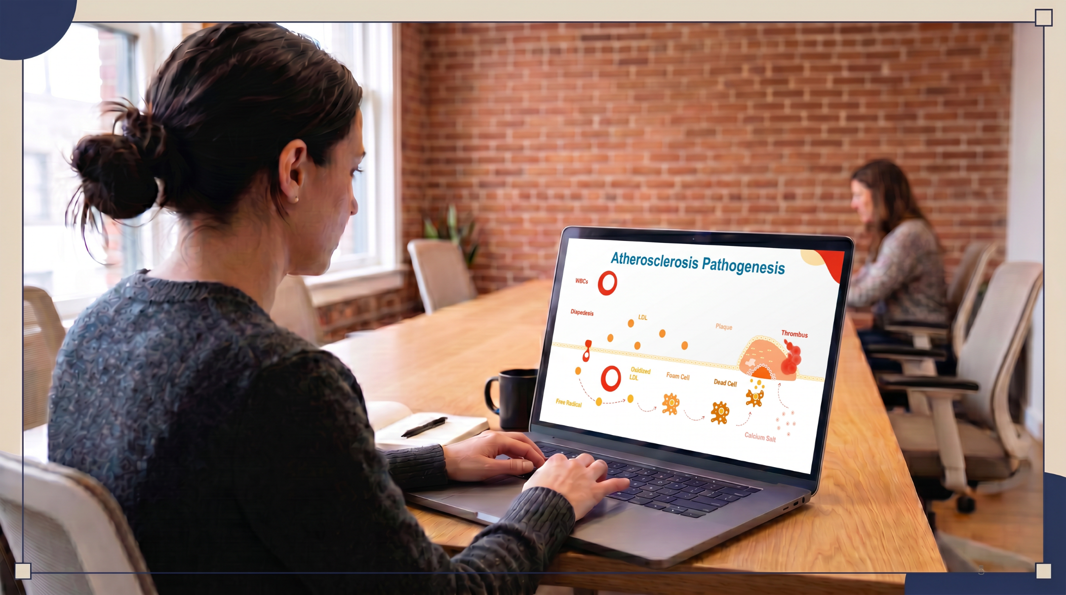 Person viewing an atherosclerosis pathogenesis PowerPoint presentation on a laptop in an office.