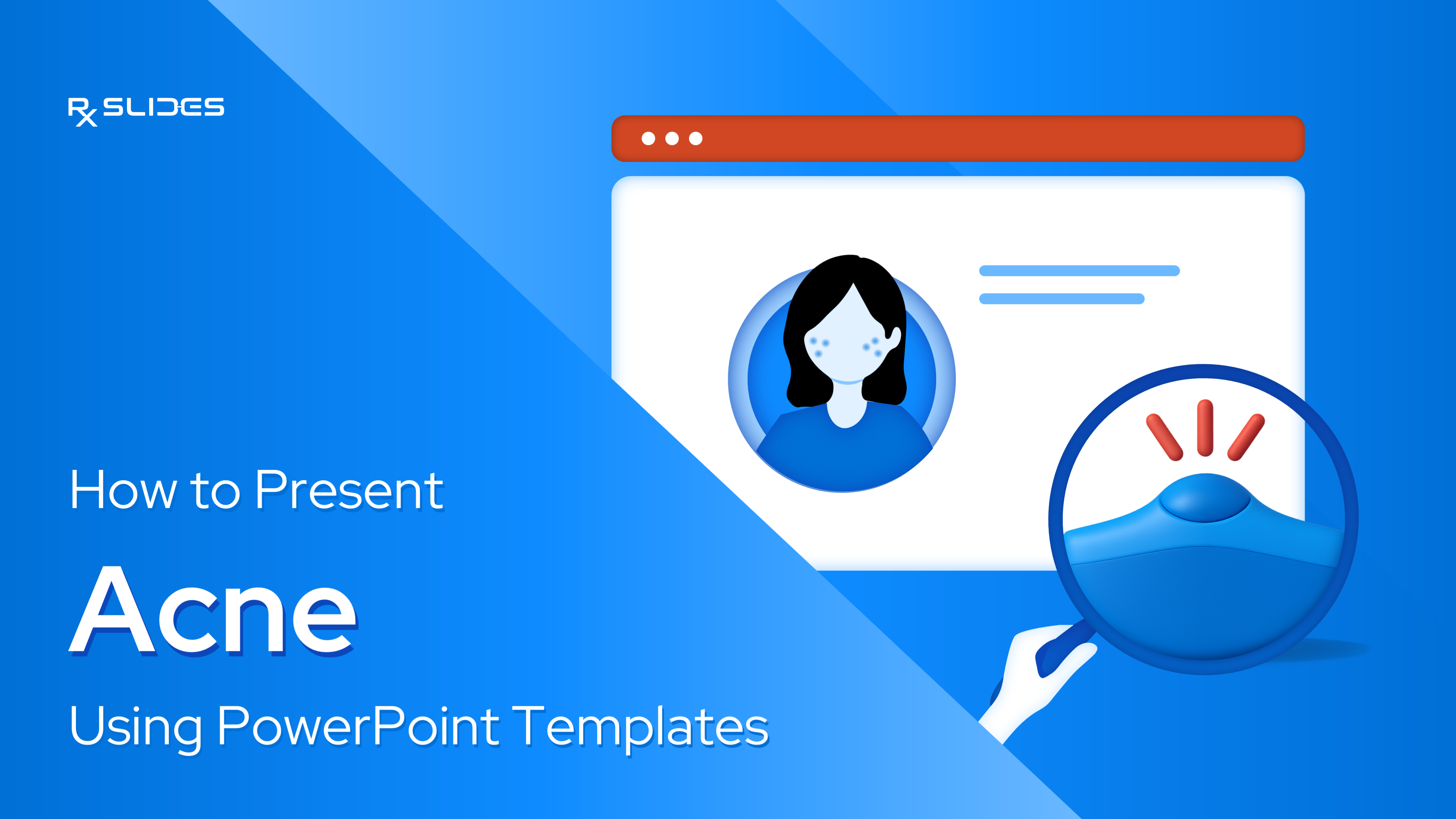 How to Present Acne Using PowerPoint Template