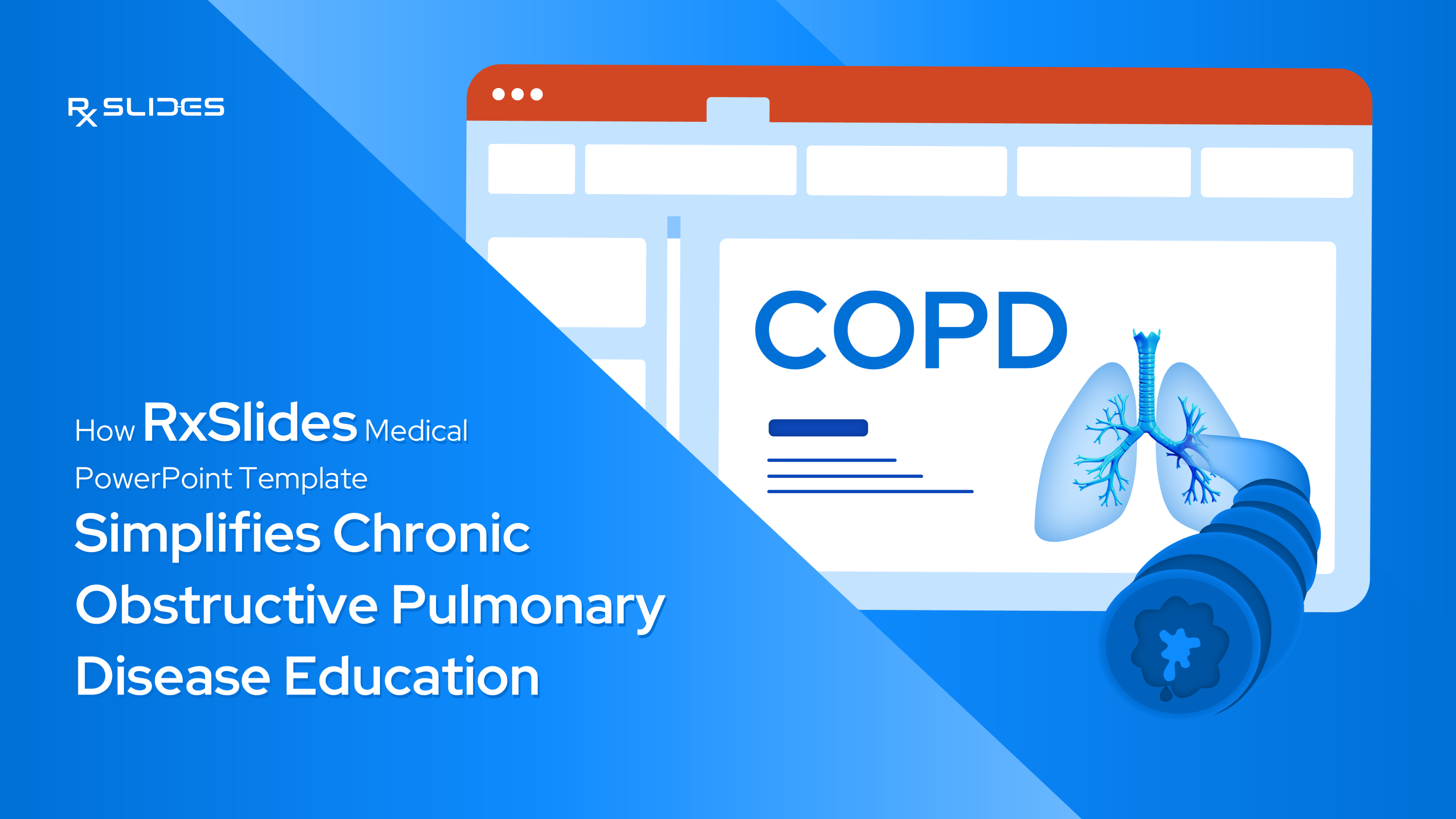 How RxSlides Medical PowerPoint Template Simplifies Chronic Obstructive Pulmonary Disease Education