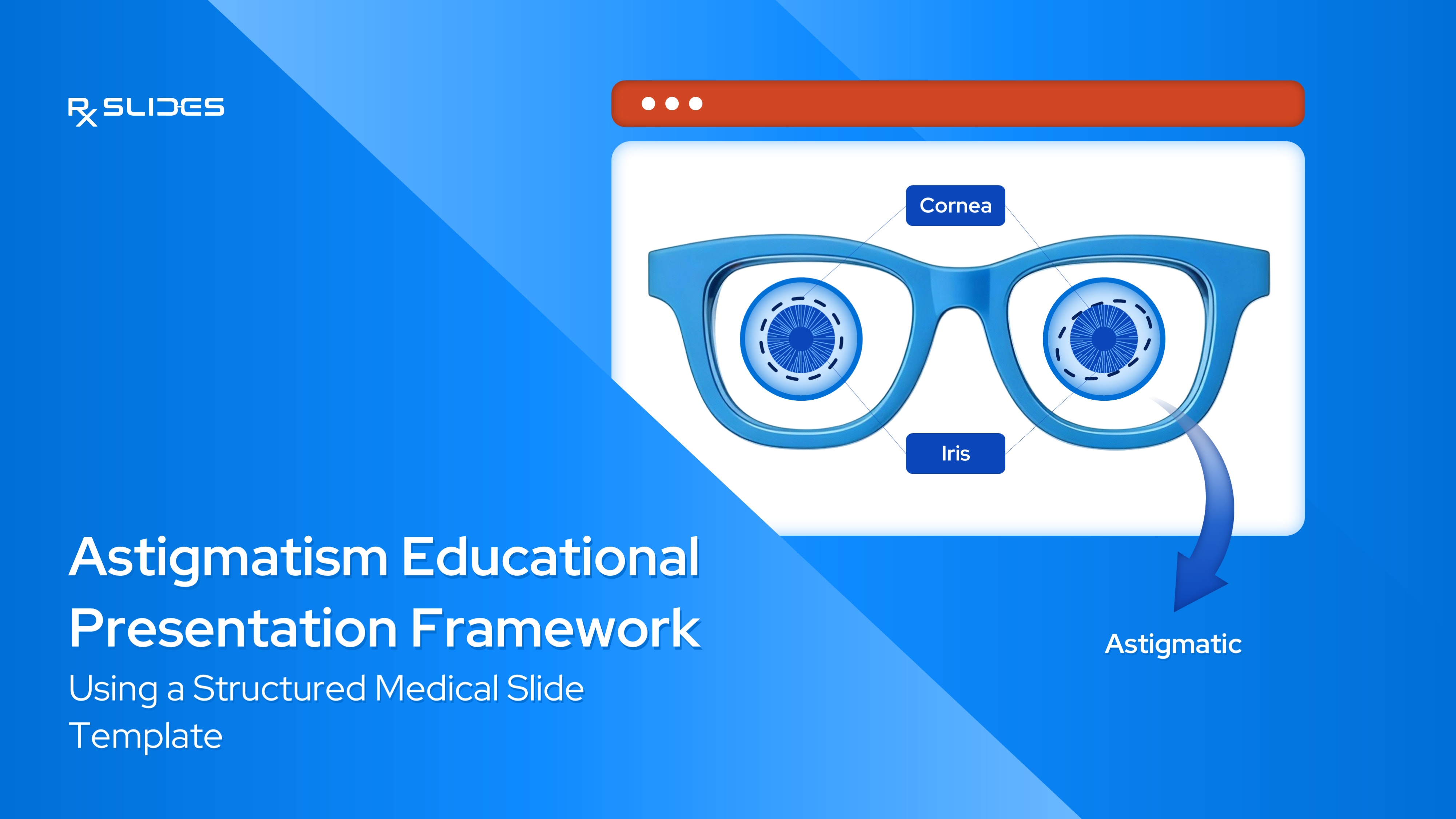 Astigmatism Educational Presentation Framework Using a Structured Medical Slide Template