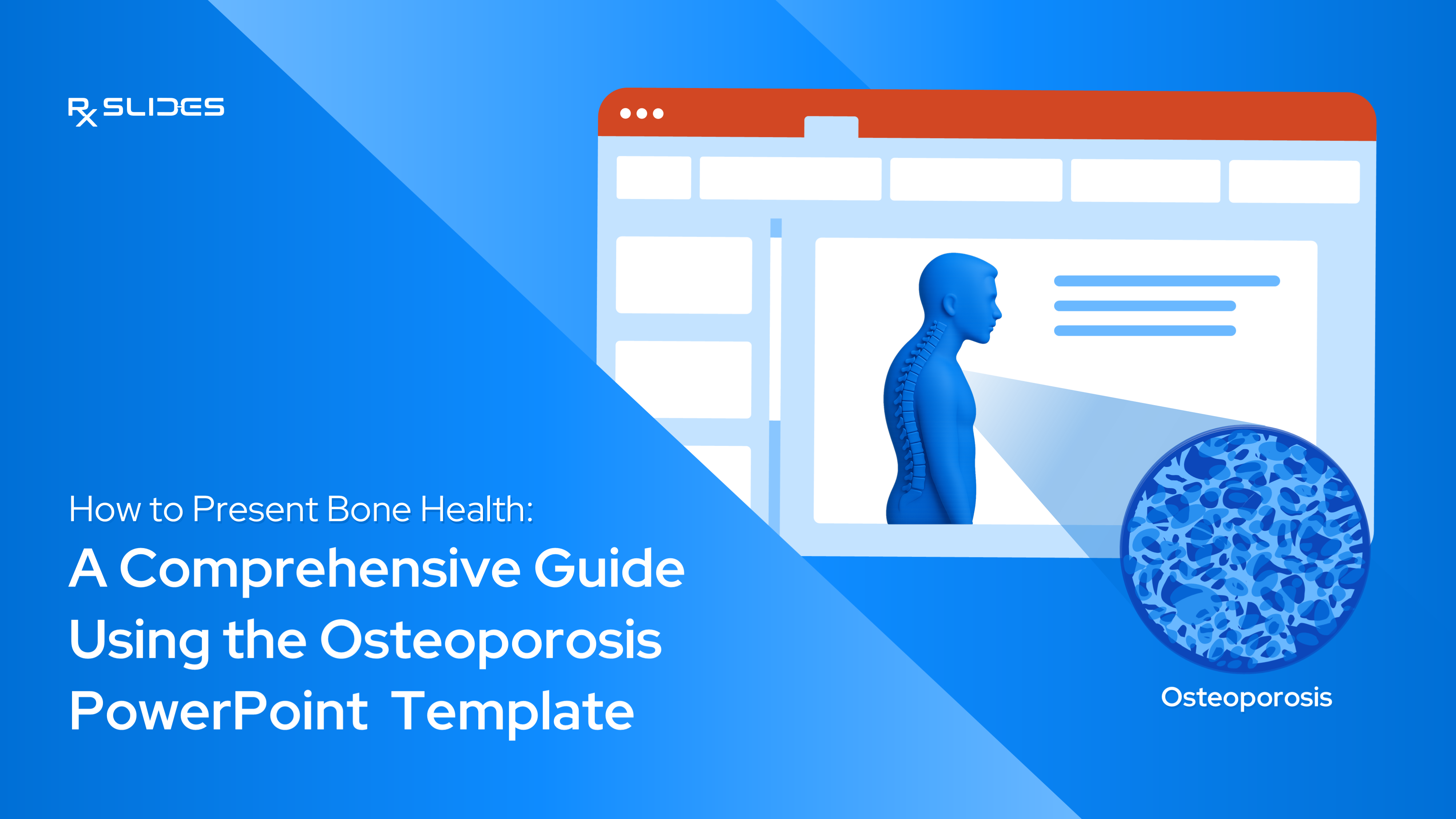 How to Present Bone Health: A Comprehensive Guide Using the Osteoporosis PowerPoint Template