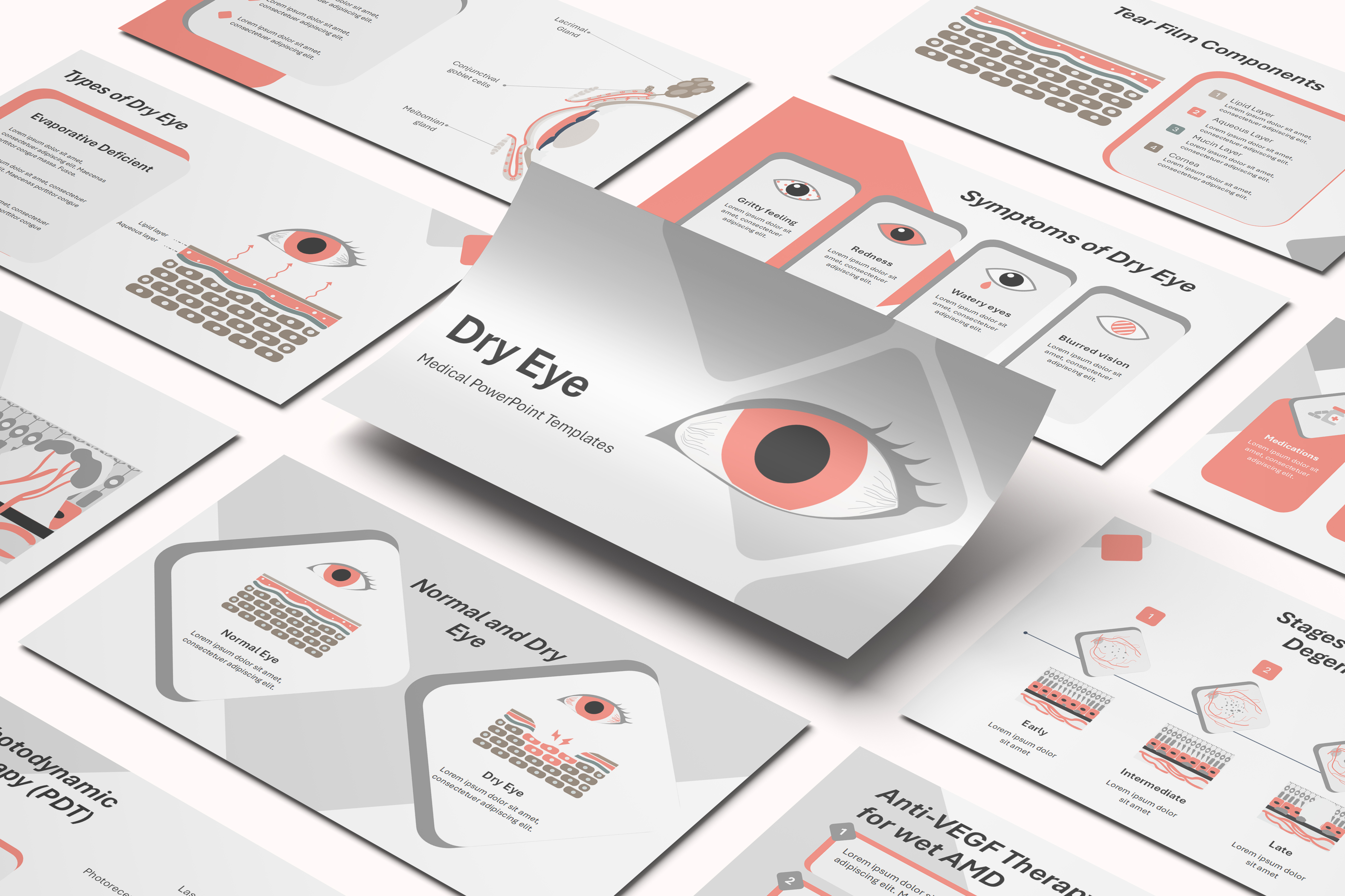 Dry Eye PowerPoint Template