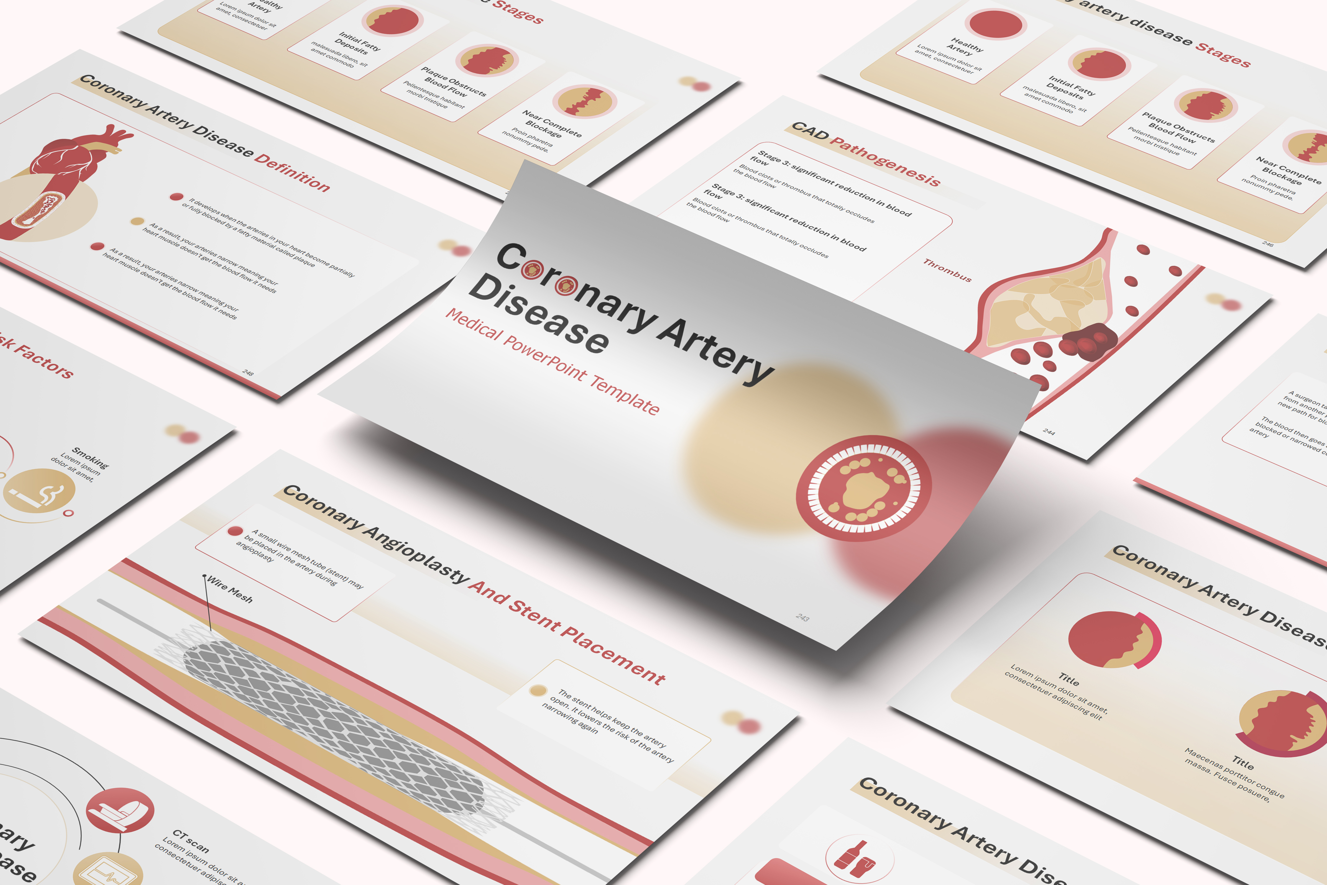 Coronary Artery Disease PowerPoint Template