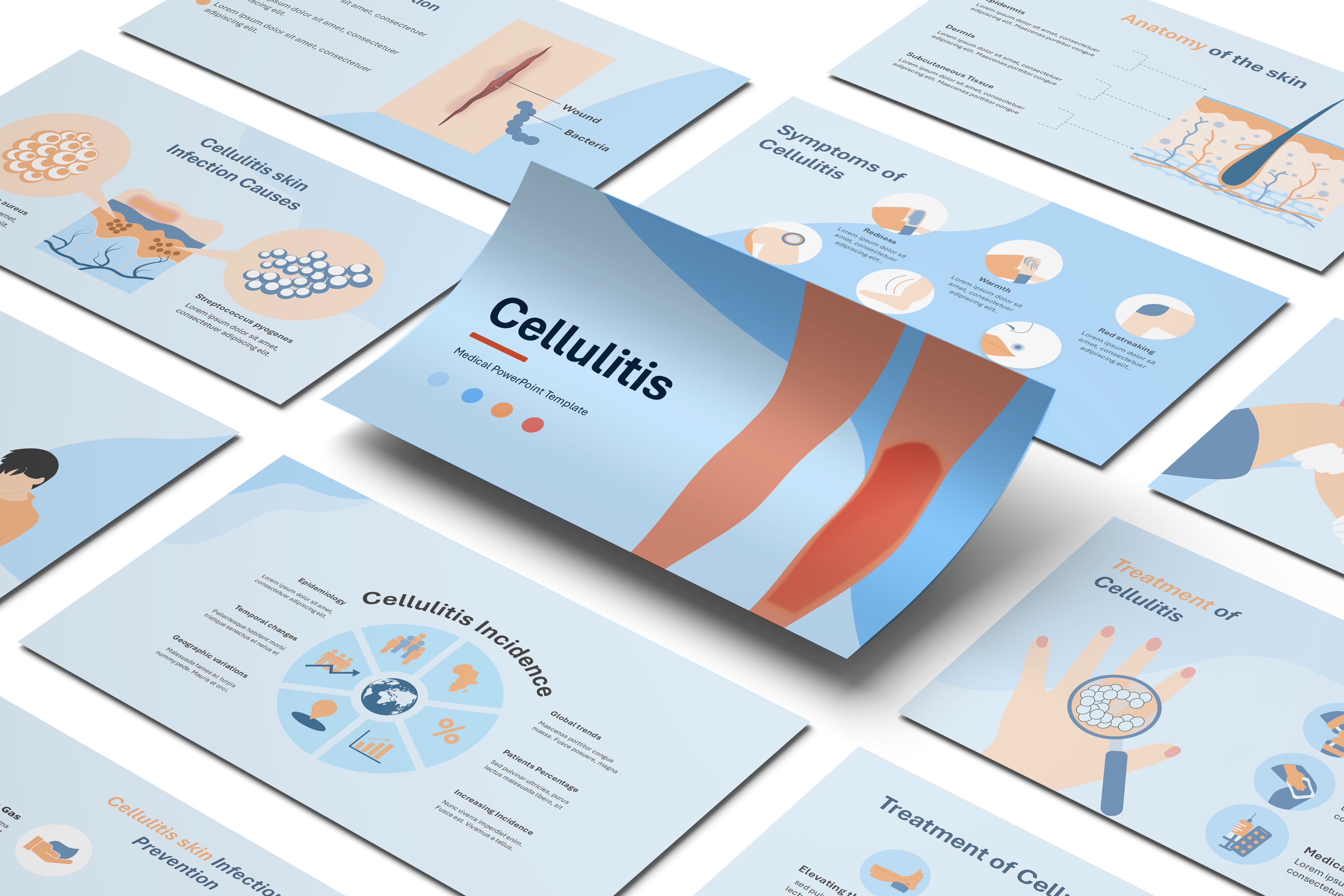 Cellulitis PowerPoint Template