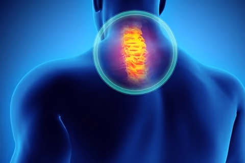 A pinched nerve could be one of the common neck pain causes.