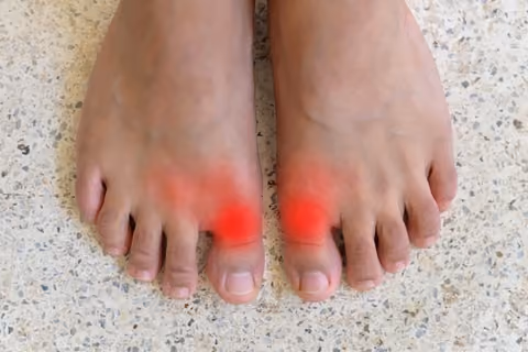 Swollen joints are one of the early arthritis symptoms.